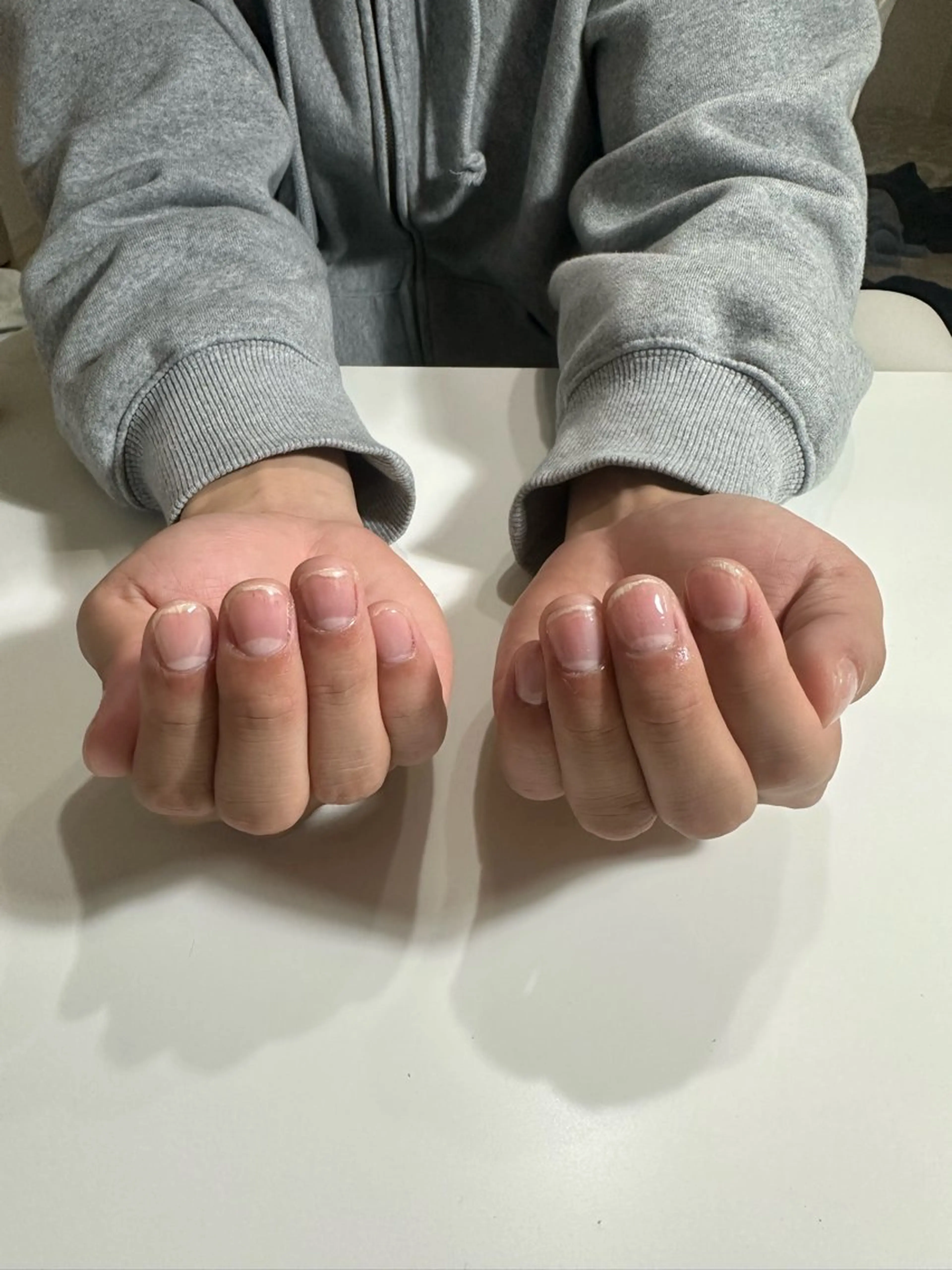 クリアネイルの写真