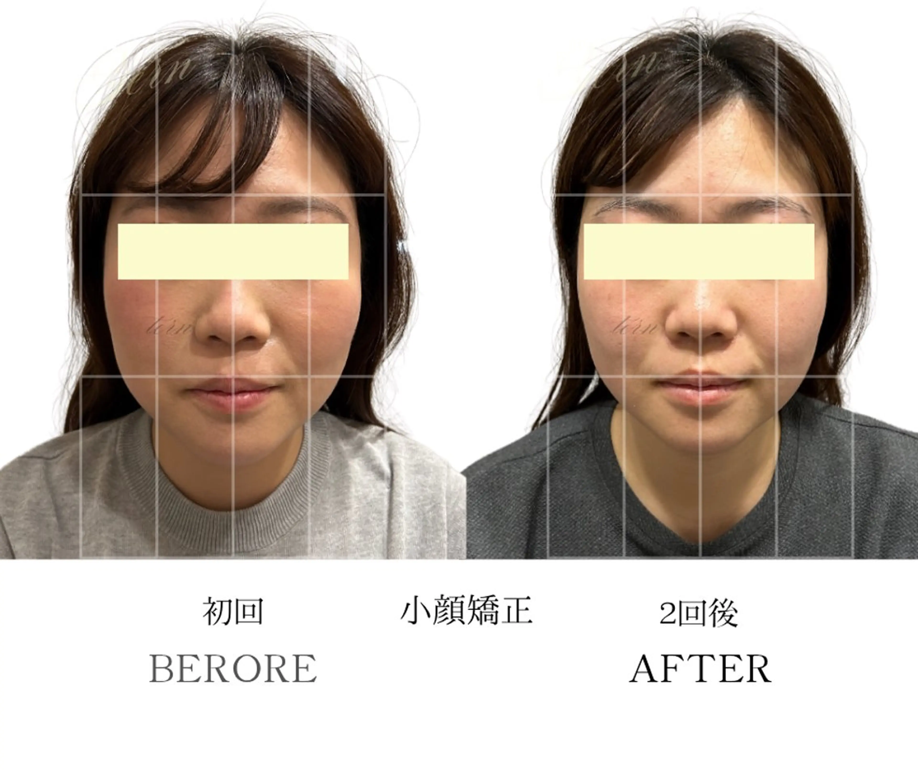 【最先端技術】骨格から変わる！小顔矯正＋首肩矯正＋身体の歪み矯正の写真