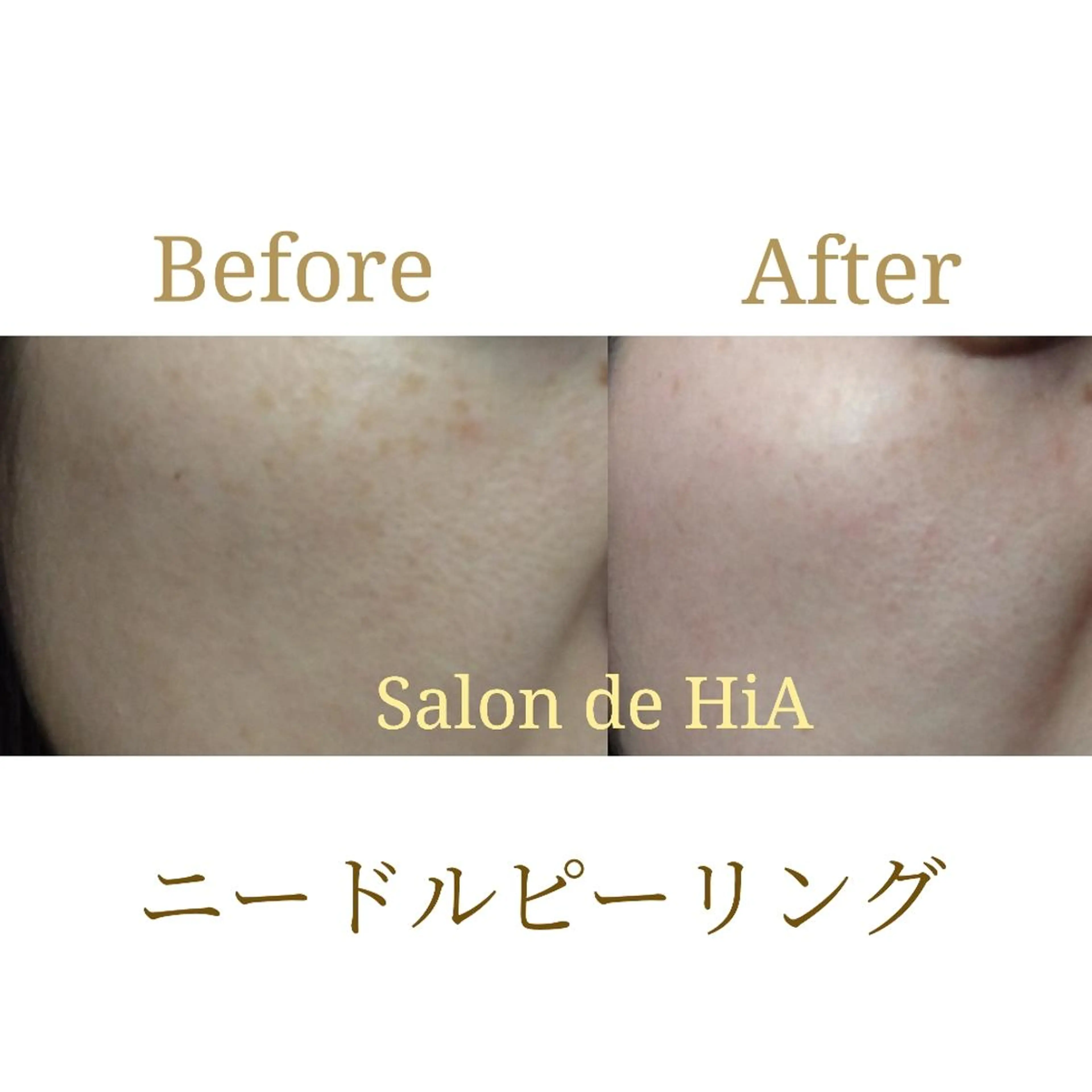 エステ Salon de  HiAのエステ・リラクイメージ