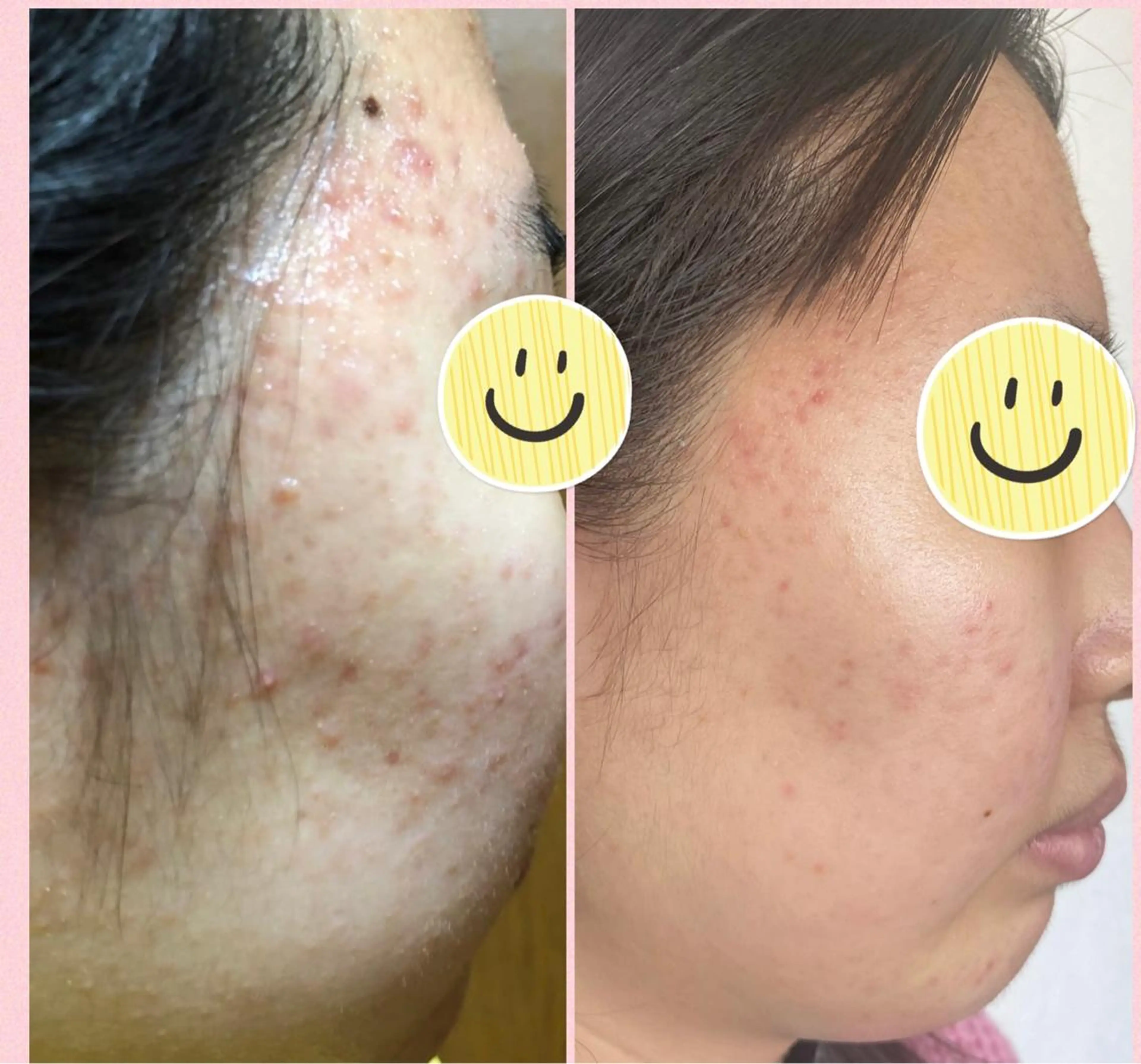 Narisビューティサロン デアイム所属・ささき ひとみのエステ・リラクイメージ