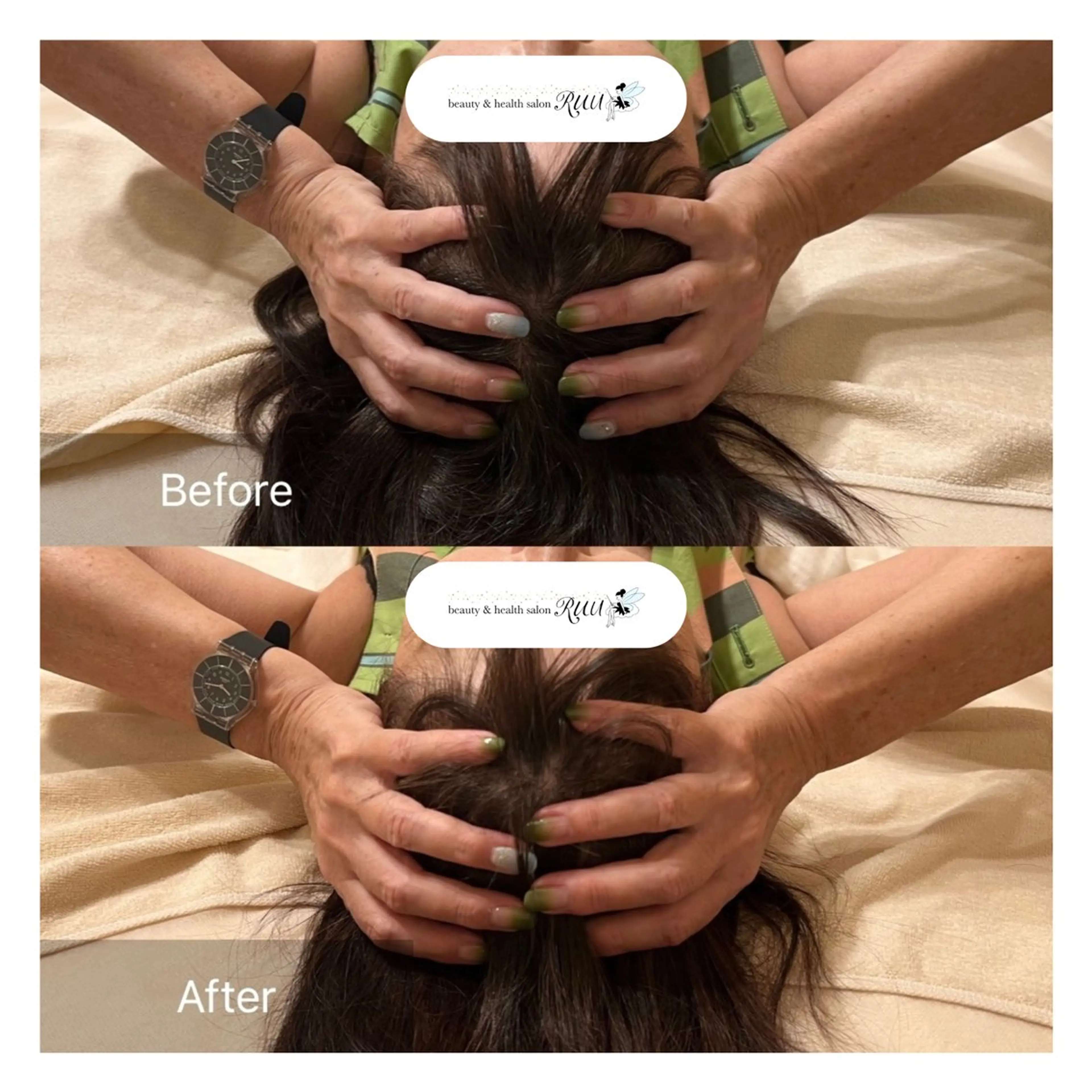 リラク 【頭痛、睡眠改善】 salon RUUのエステ・リラクイメージ