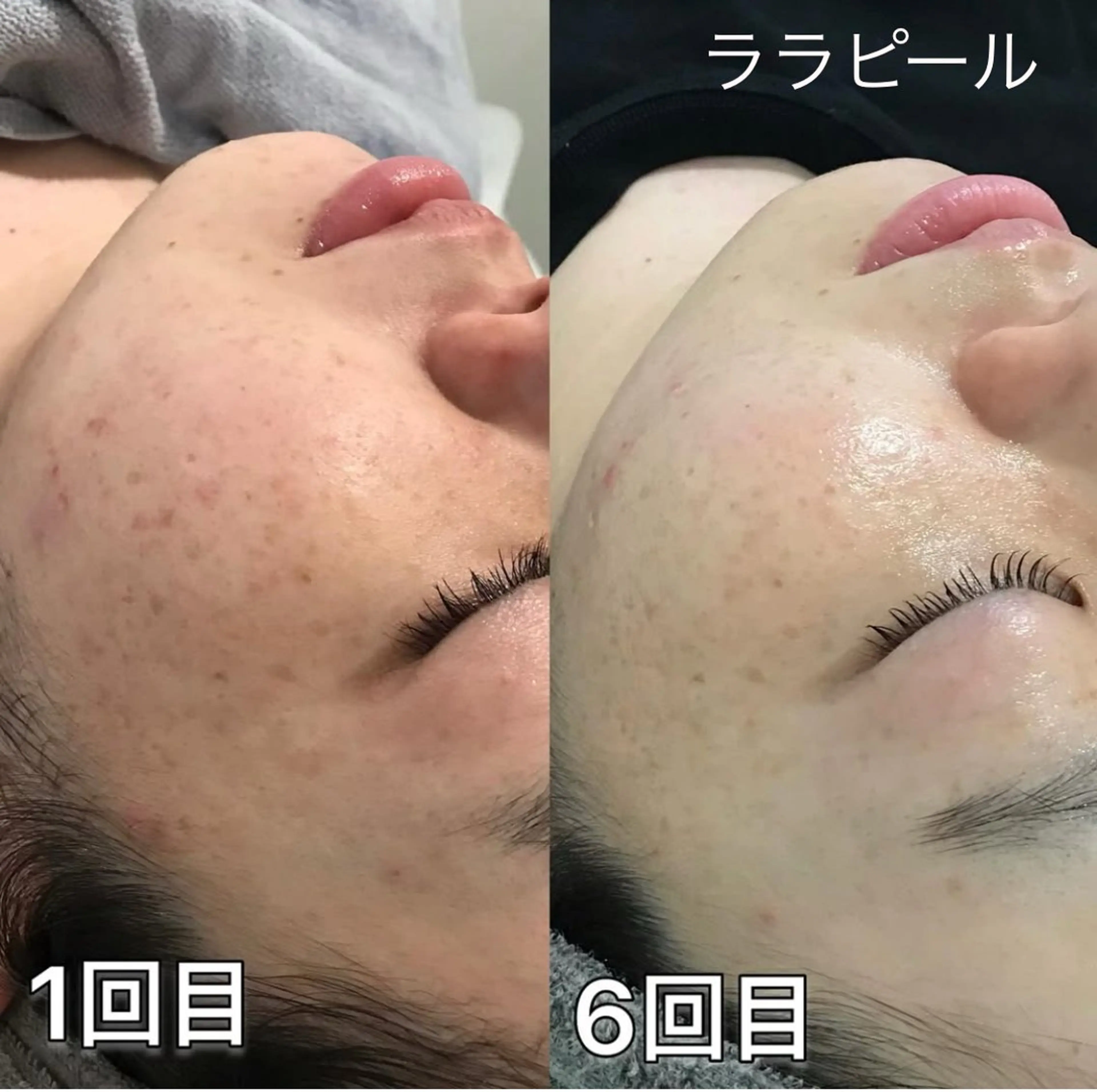 天神 MeMeのエステ・リラクイメージ