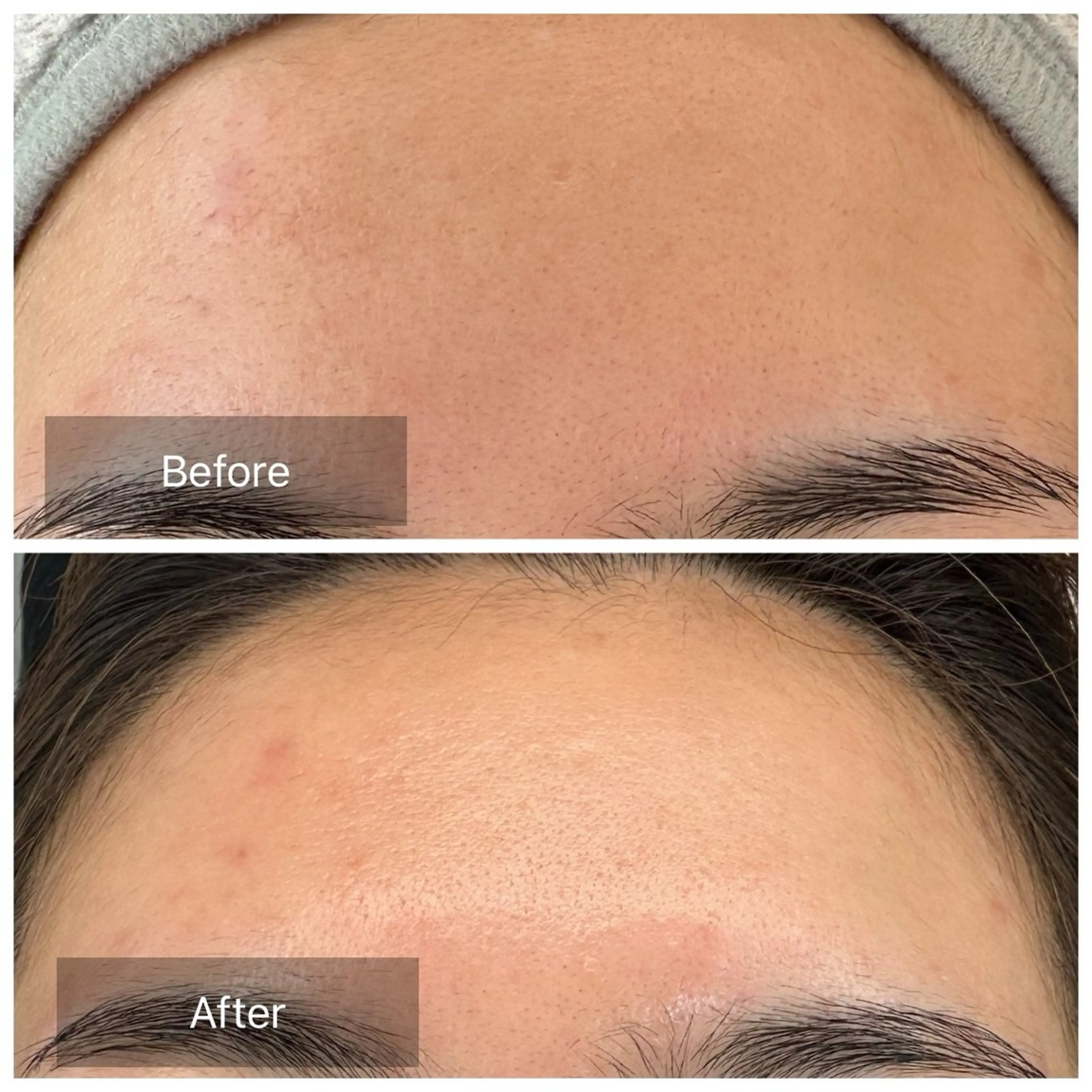 脱毛 トータルしみケア専門 NICA(ニカ)のエステ・リラクイメージ