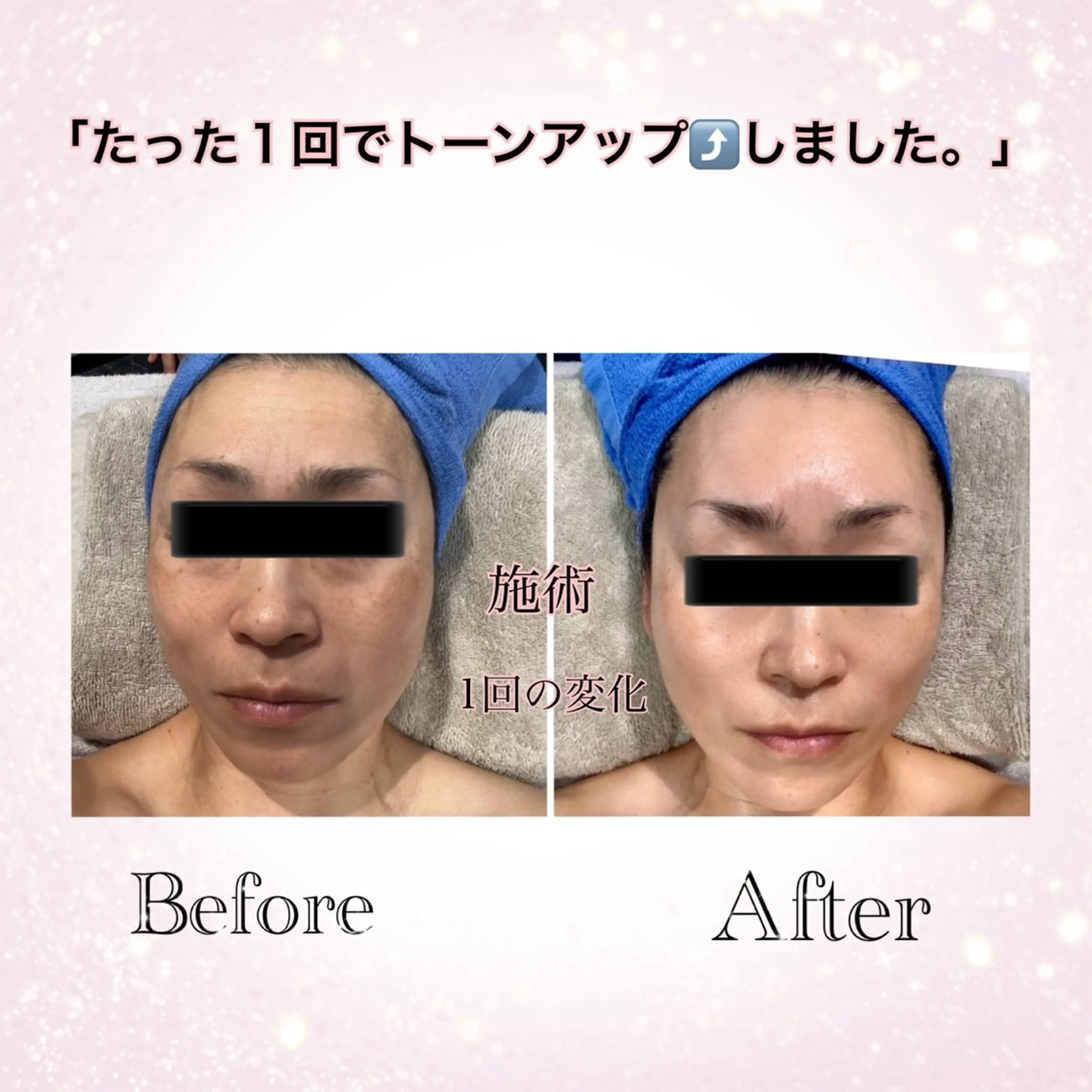 フェイシャルマッサージの写真