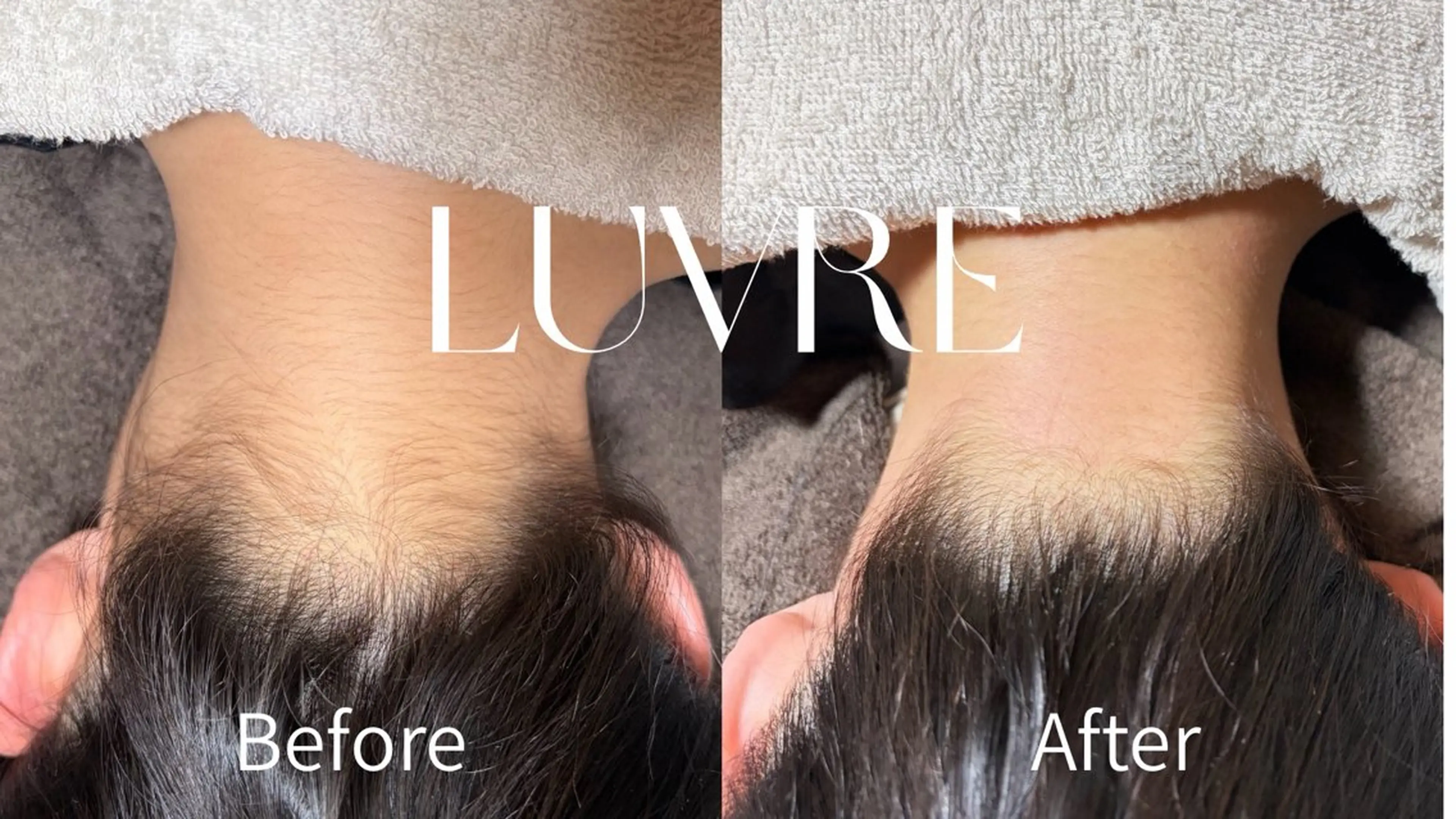 脱毛 MIKI ミキのエステ・リラクイメージ