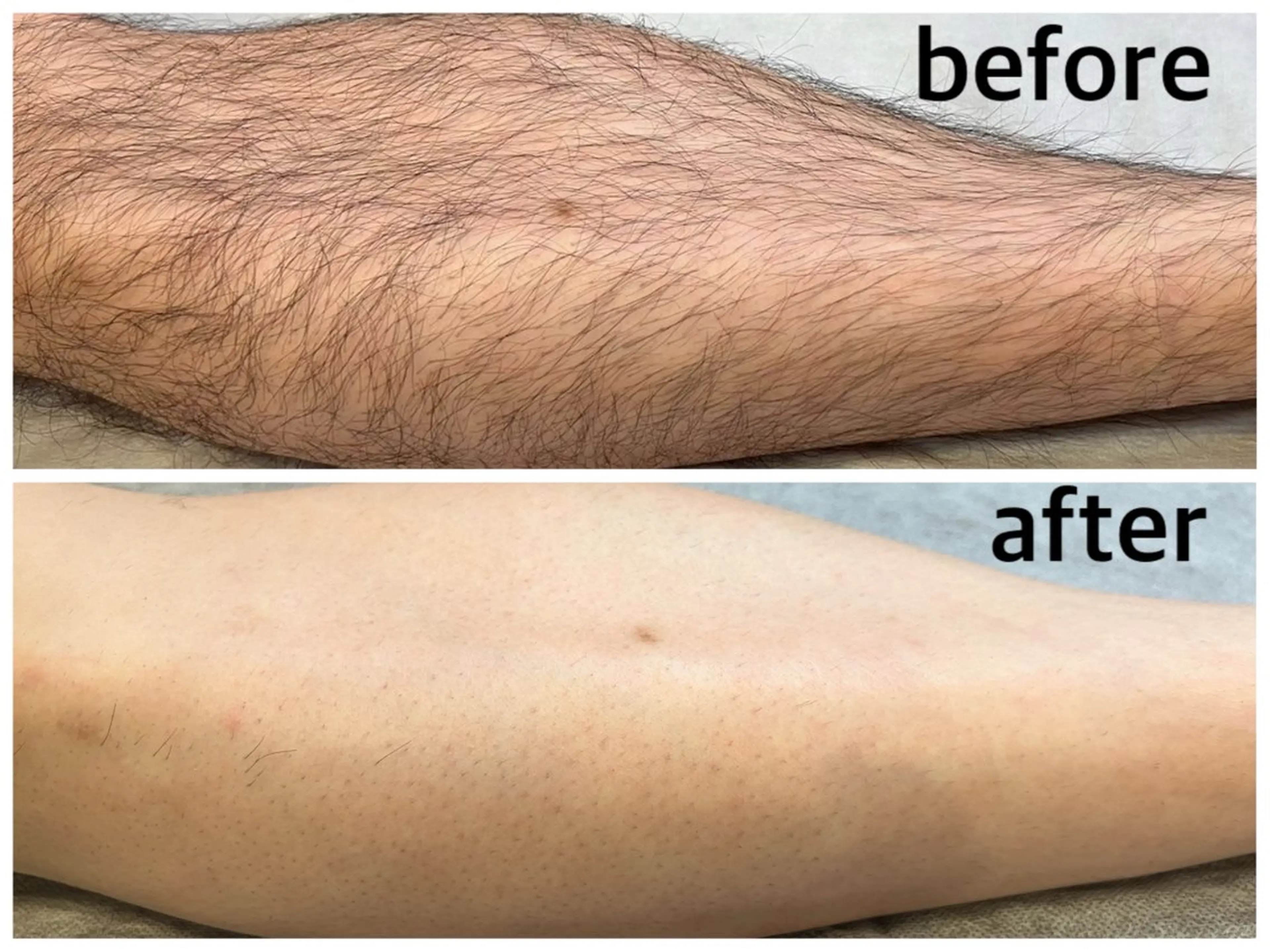 メンズ PROSOL こころのエステ・リラクイメージ