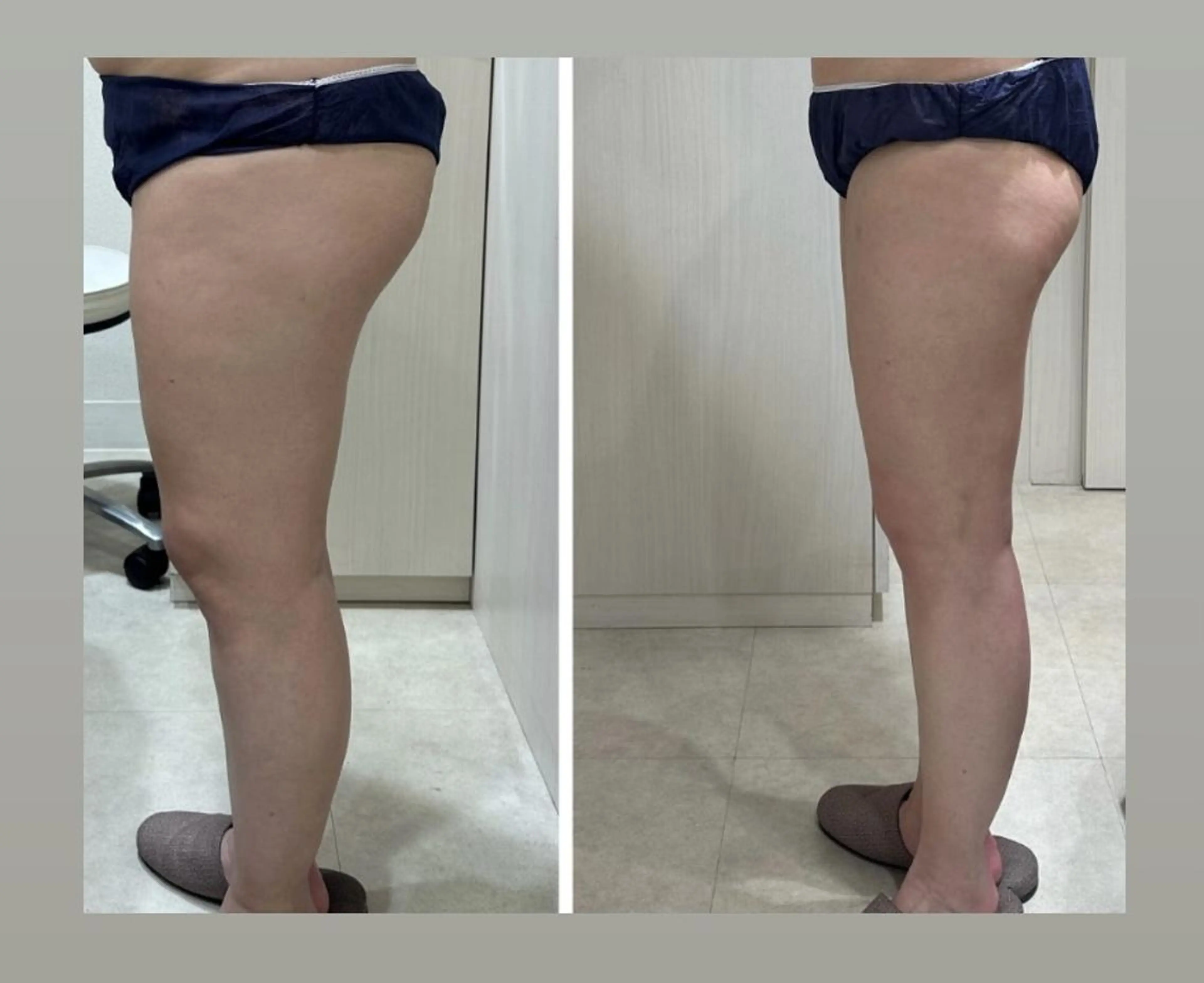 エステ リラク ♡RAYVIS♡ 名古屋店　神田のエステ・リラクイメージ