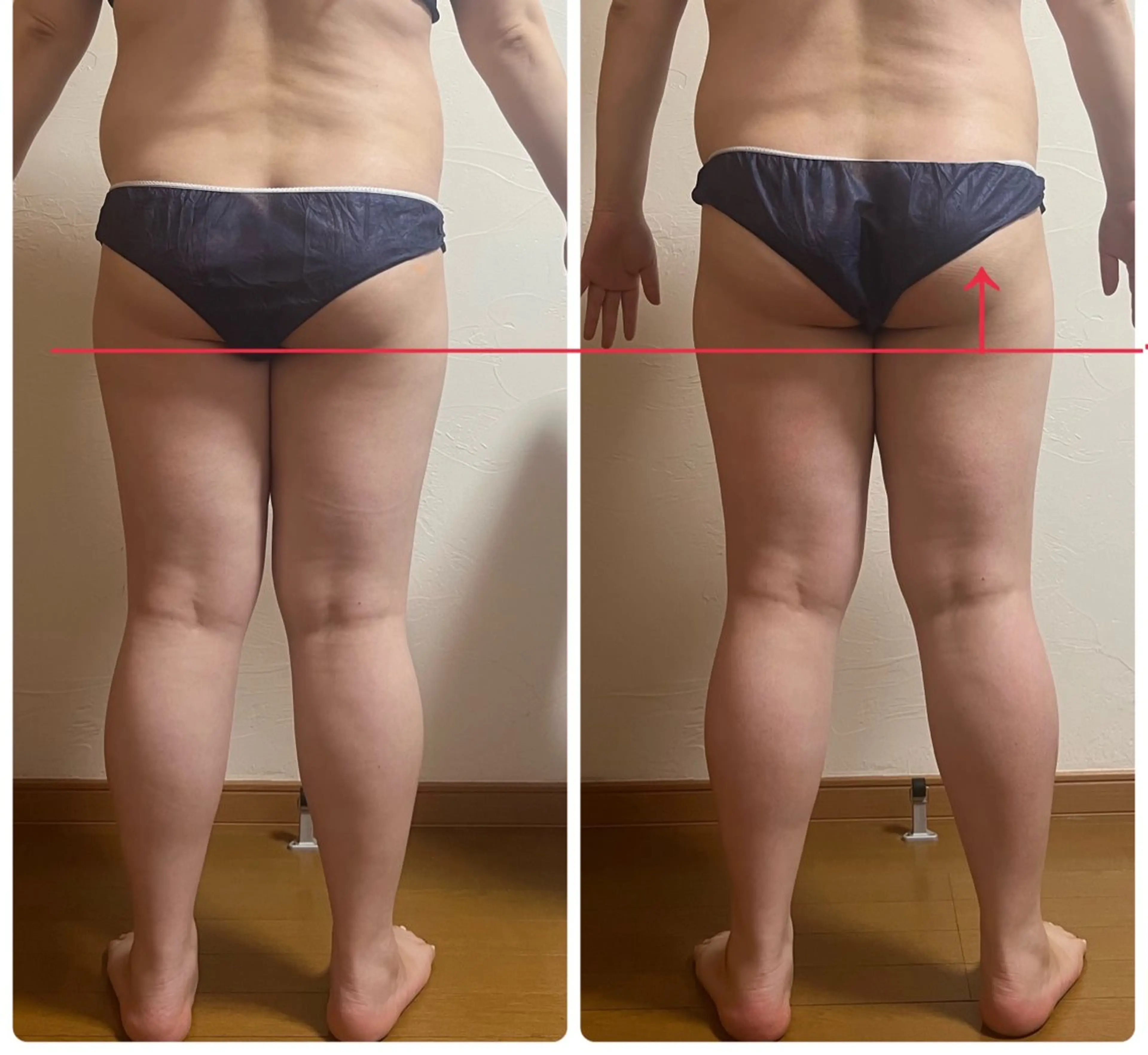 痩身下半身EMS.キャビ.超音波＋リンパマッサージ＋遠赤外線マット発汗たっぷり80分！の写真