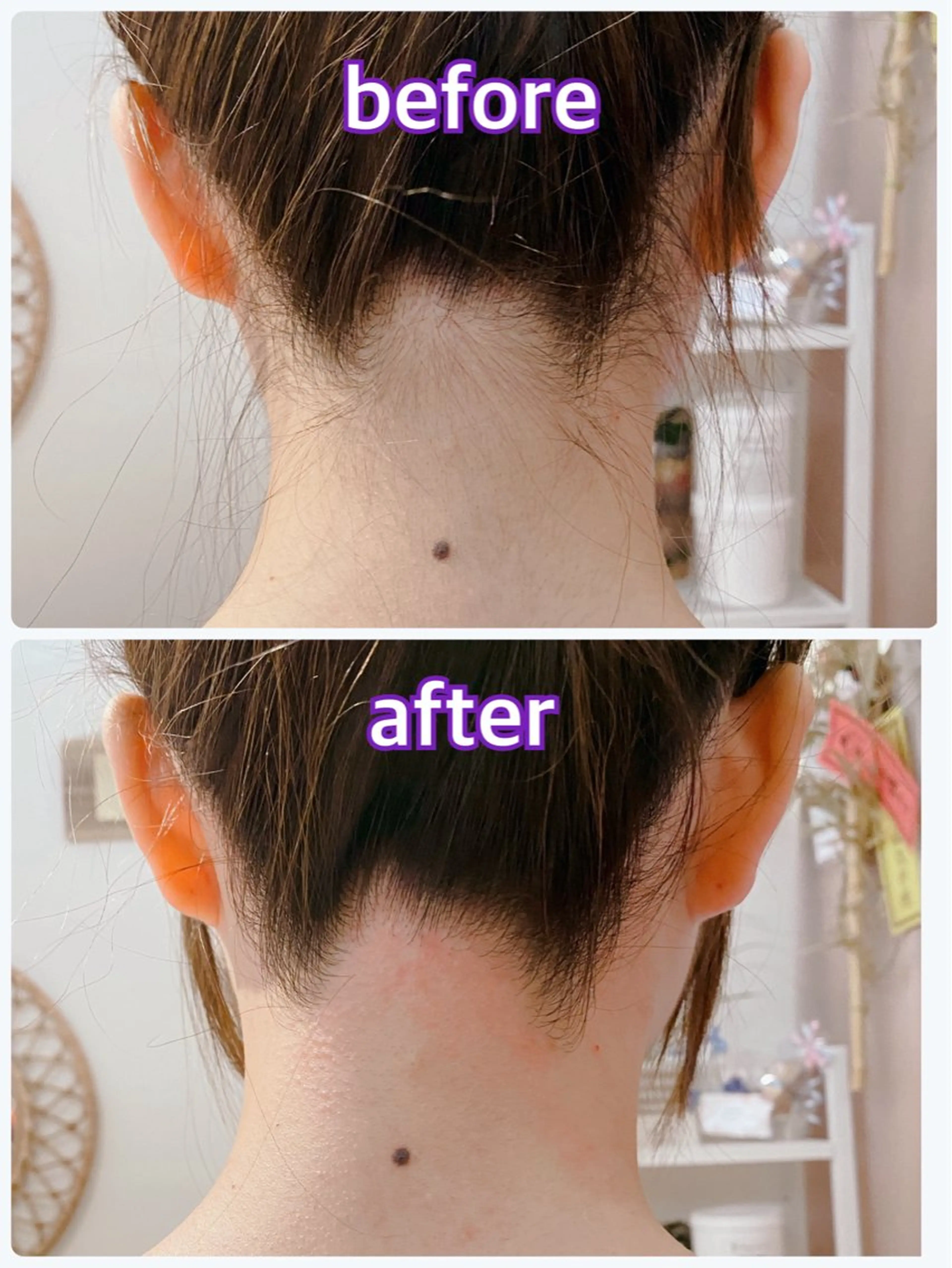 脱毛 【痩身・脱毛サロン】 REBISKIN🌱のエステ・リラクイメージ