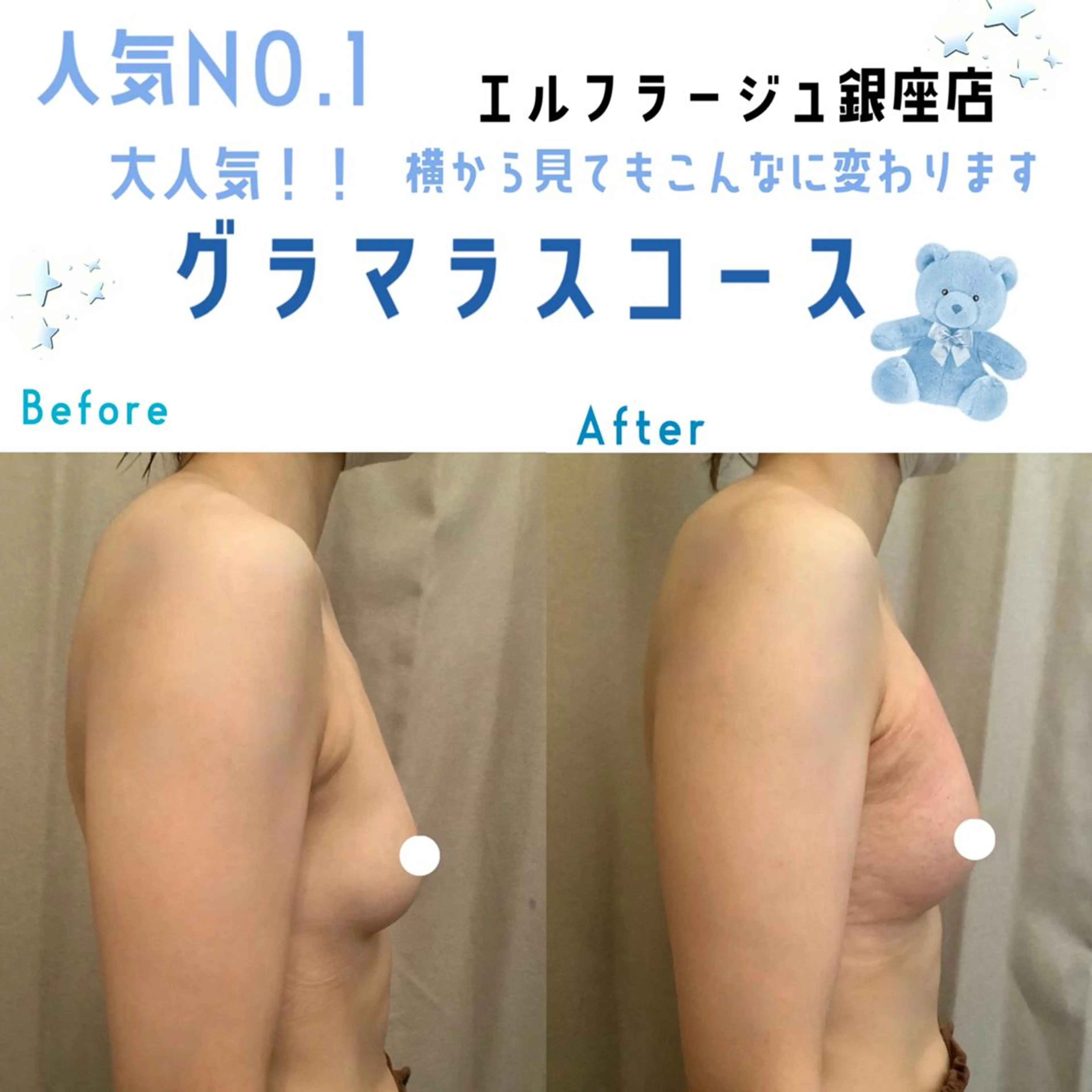 エルフラージュ 銀座店のエステ・リラクイメージ