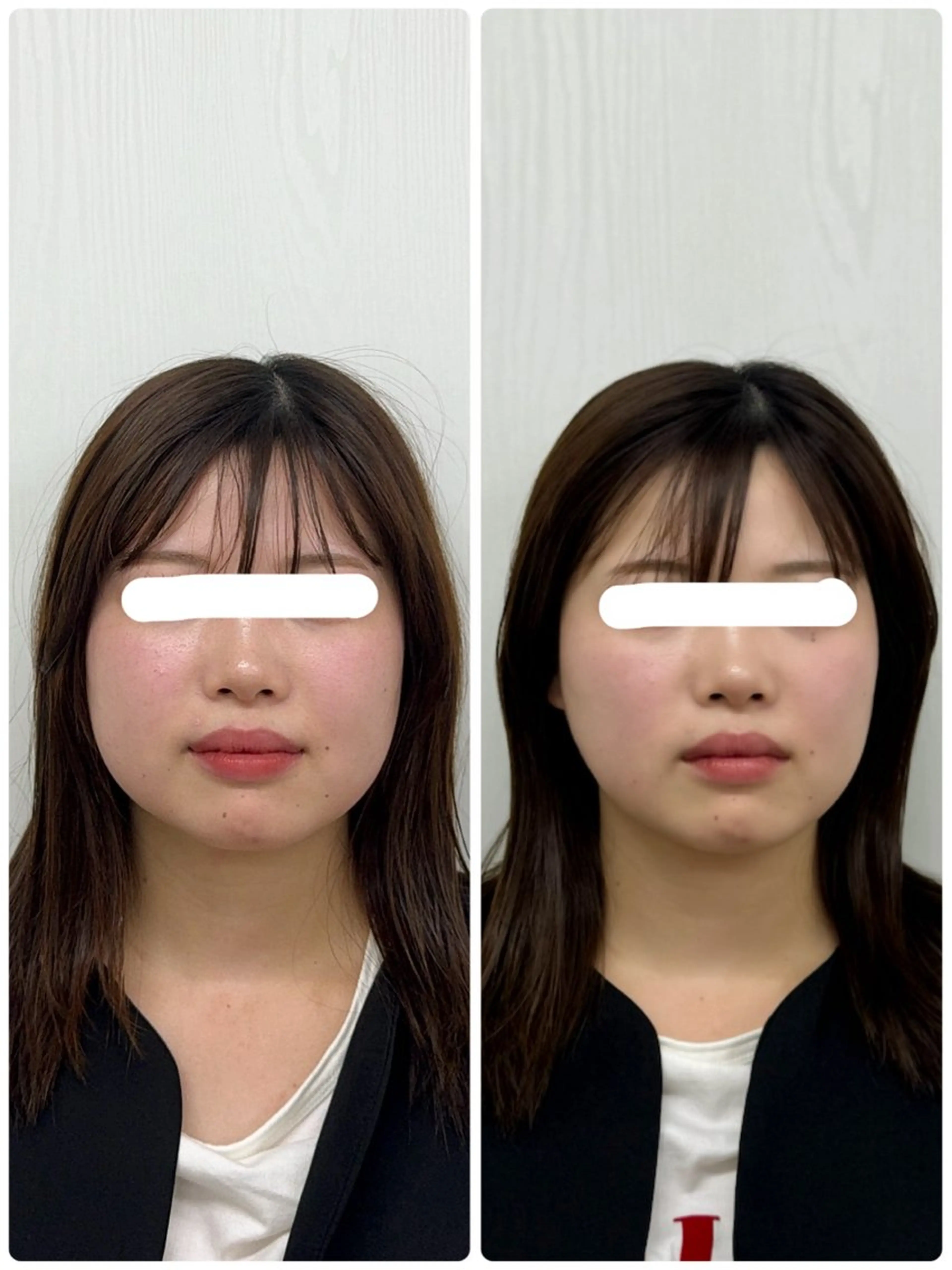 エステ リラク 美容鍼×小顔矯正 ×美容整体　浜川泰仁のエステ・リラクイメージ