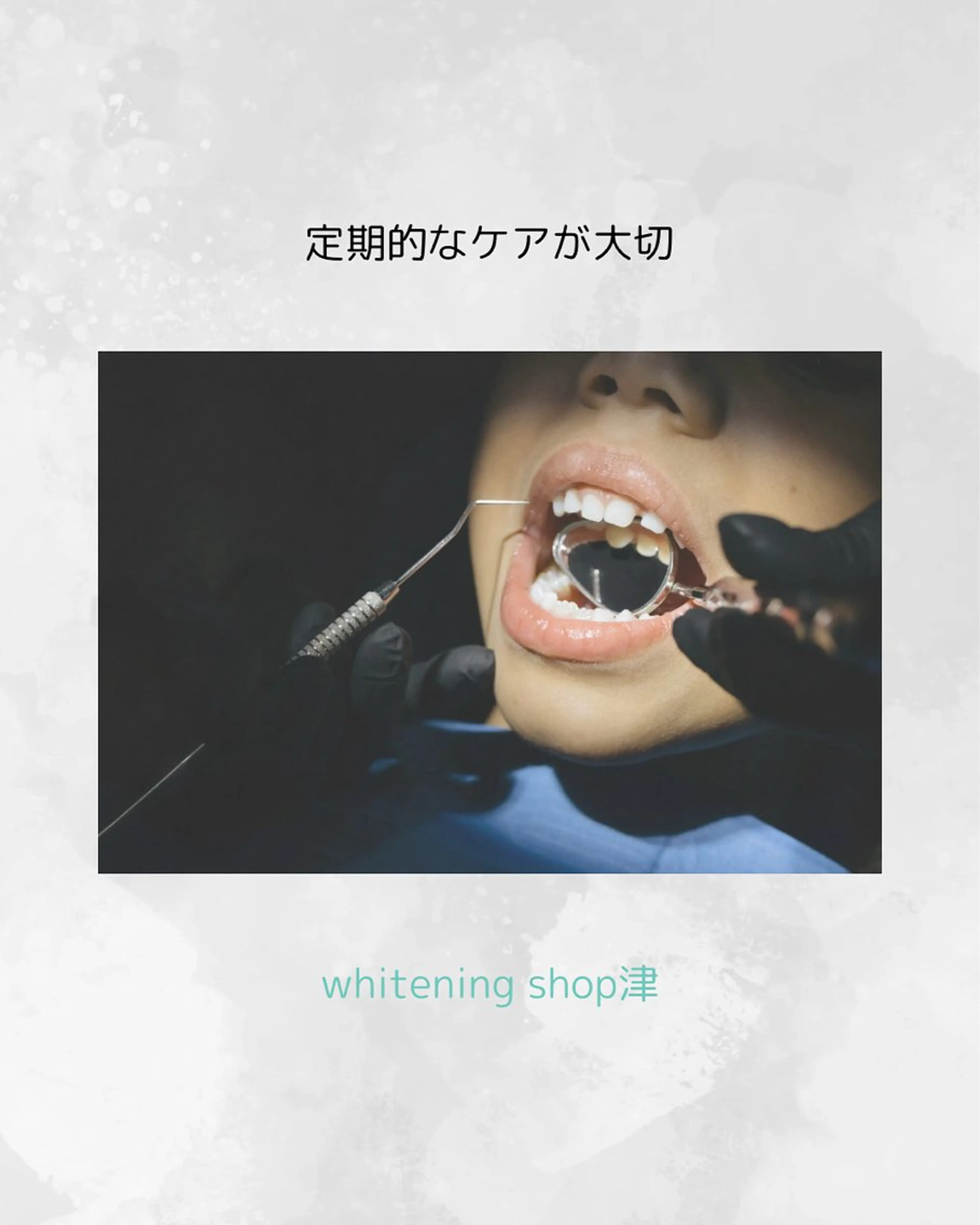 ホワイトニングショップ津店所属・ホワイトニング ショップ津店のその他イメージ