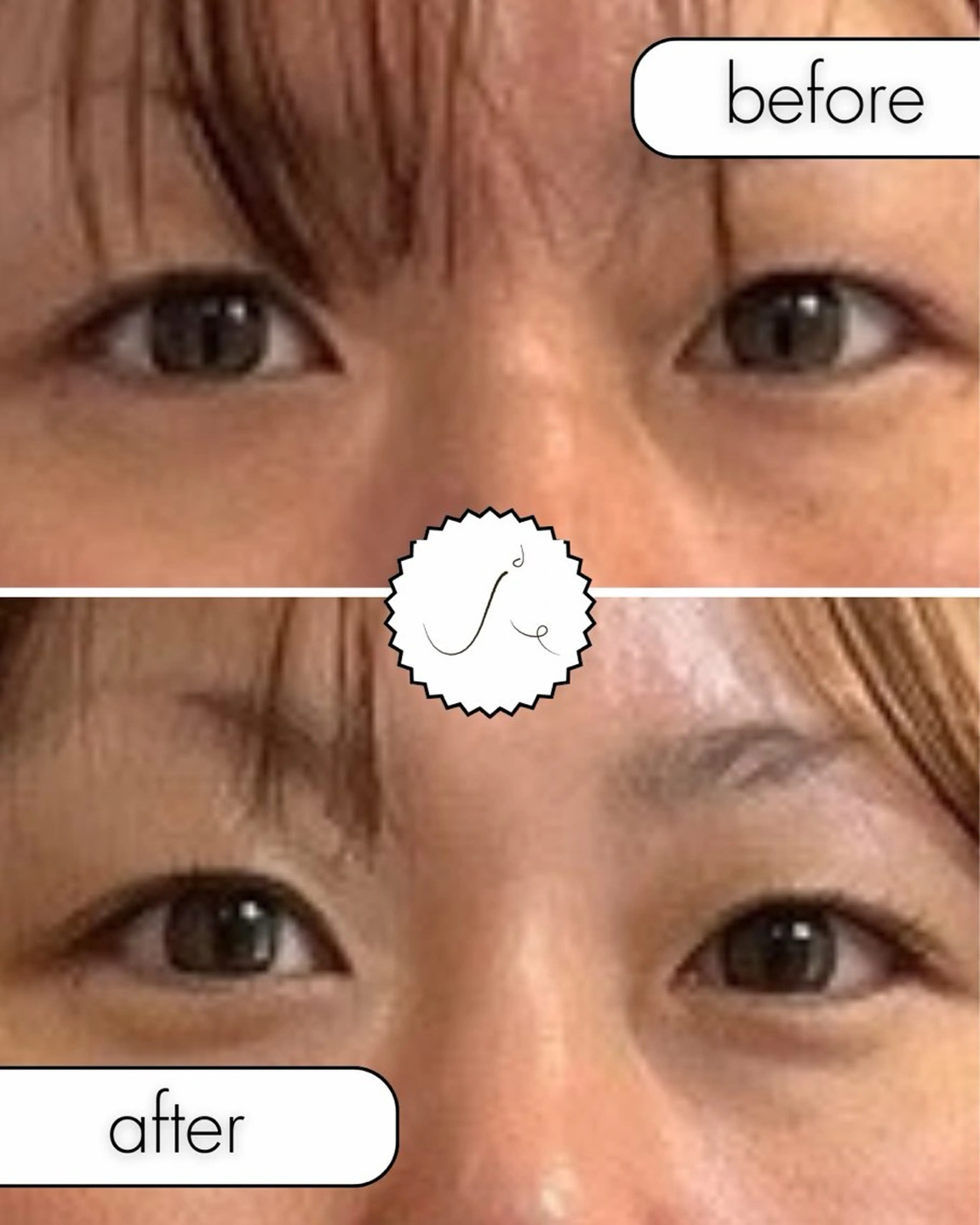 小顔美容矯正勝山式 shiroしろのエステ・リラクイメージ