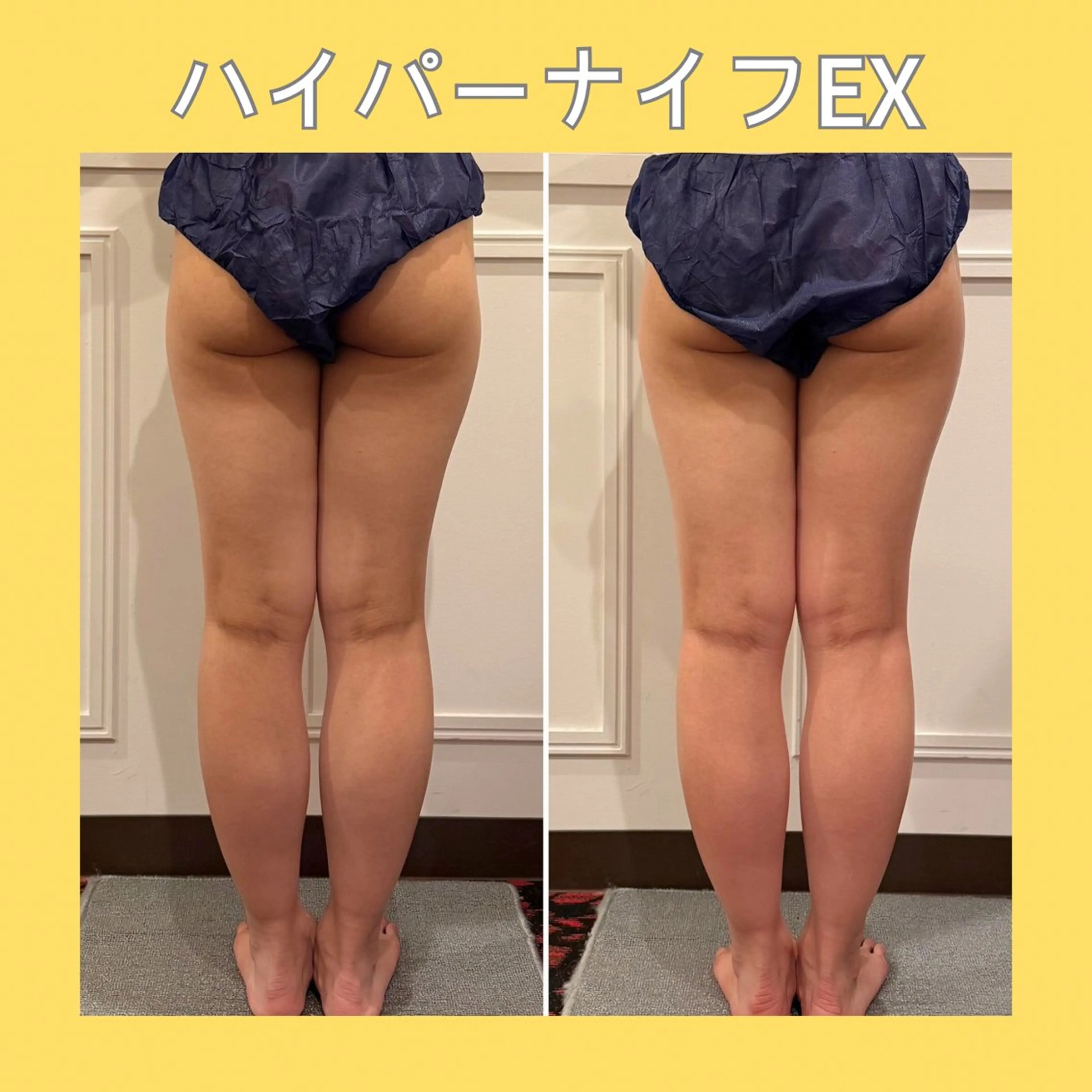 赤澤/本気痩せ・脱毛 ・ノーファンデ肌のエステ・リラクイメージ