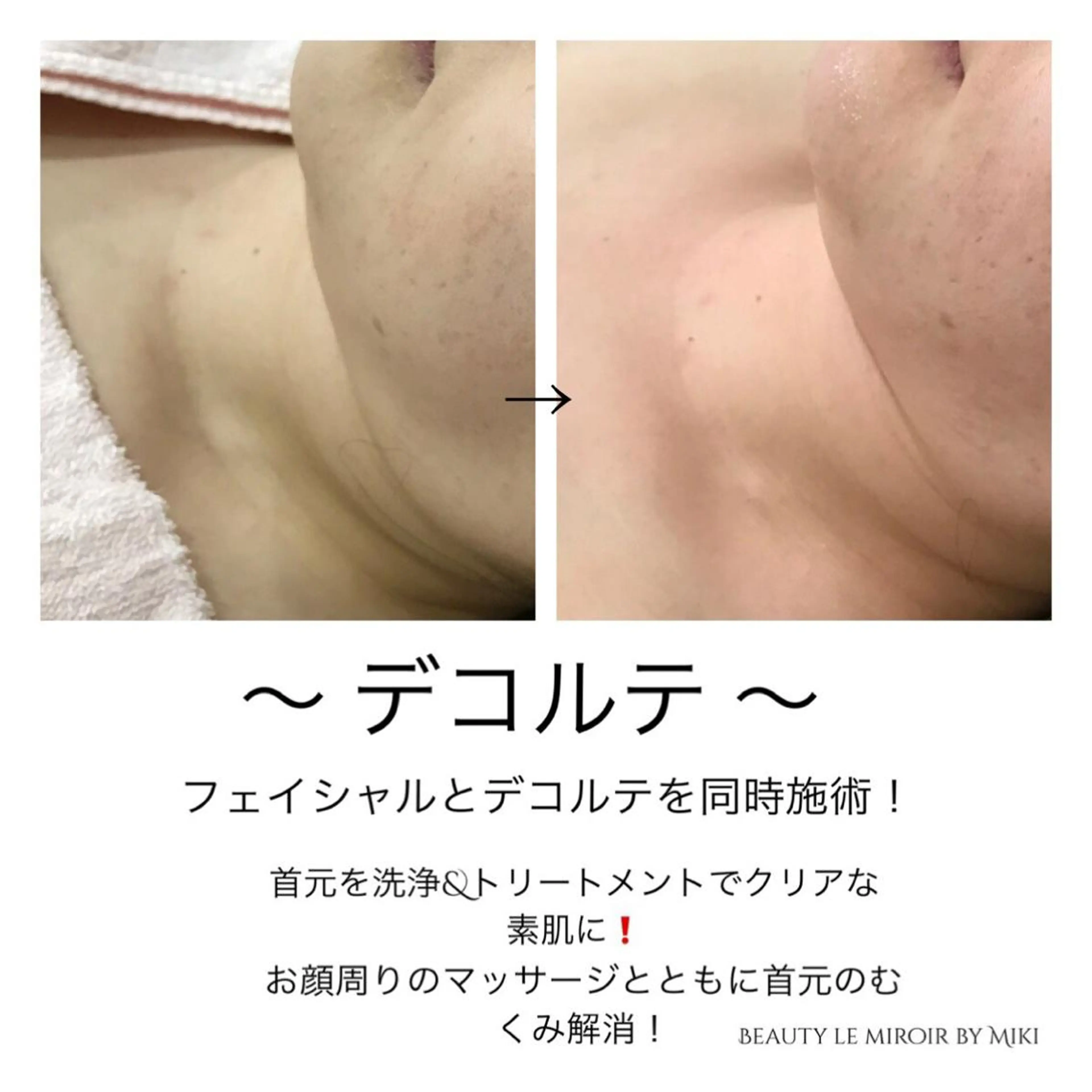 エステ ビューティー ミロワールのエステ・リラクイメージ