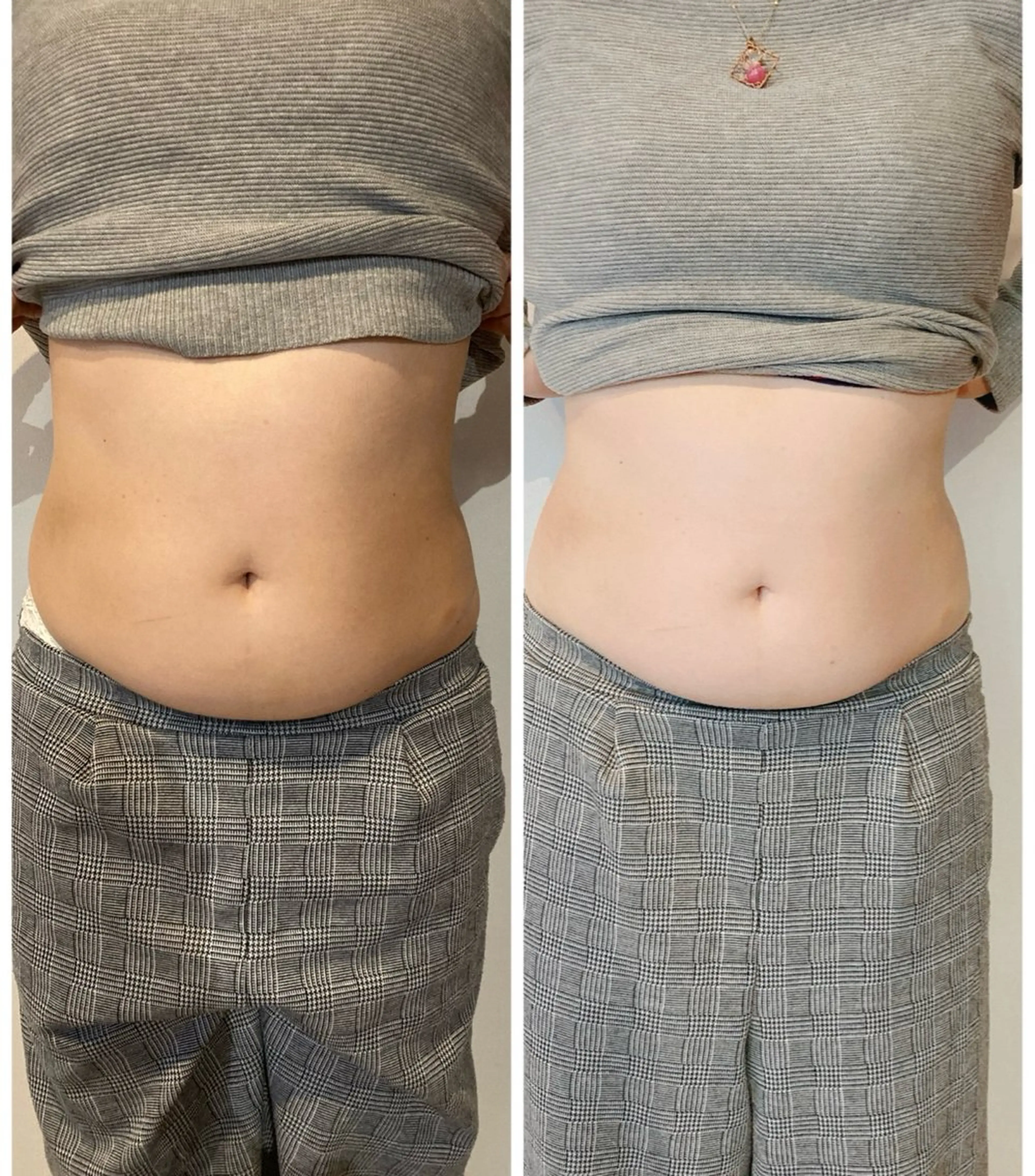 便秘下痢ぽっこりお腹に‼︎腸もみ整腸マッサージの写真