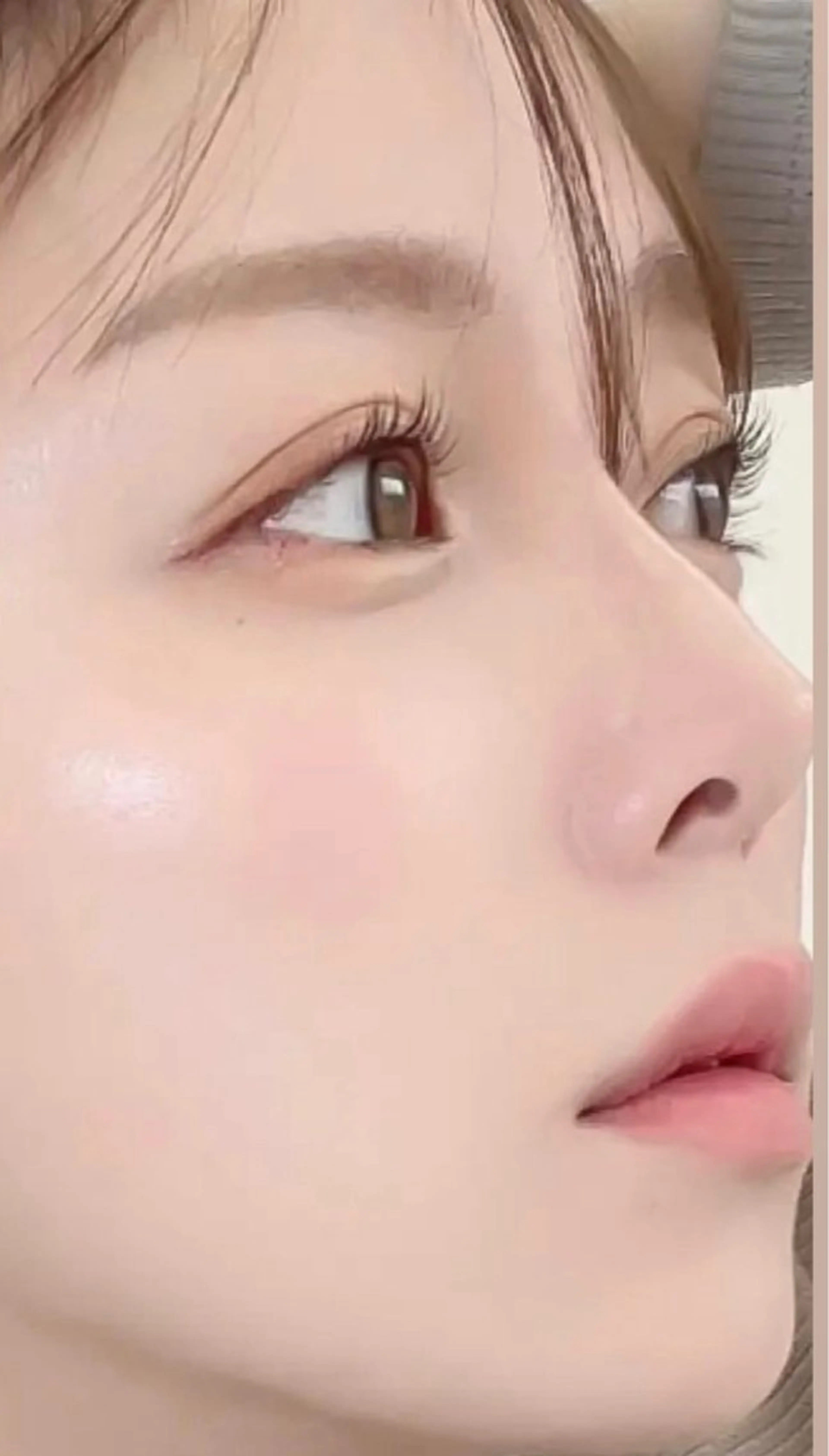 レディース限定！👱🏻‍♀️お顔👩脱毛🌟LEDフェイシャルパック付き！の写真