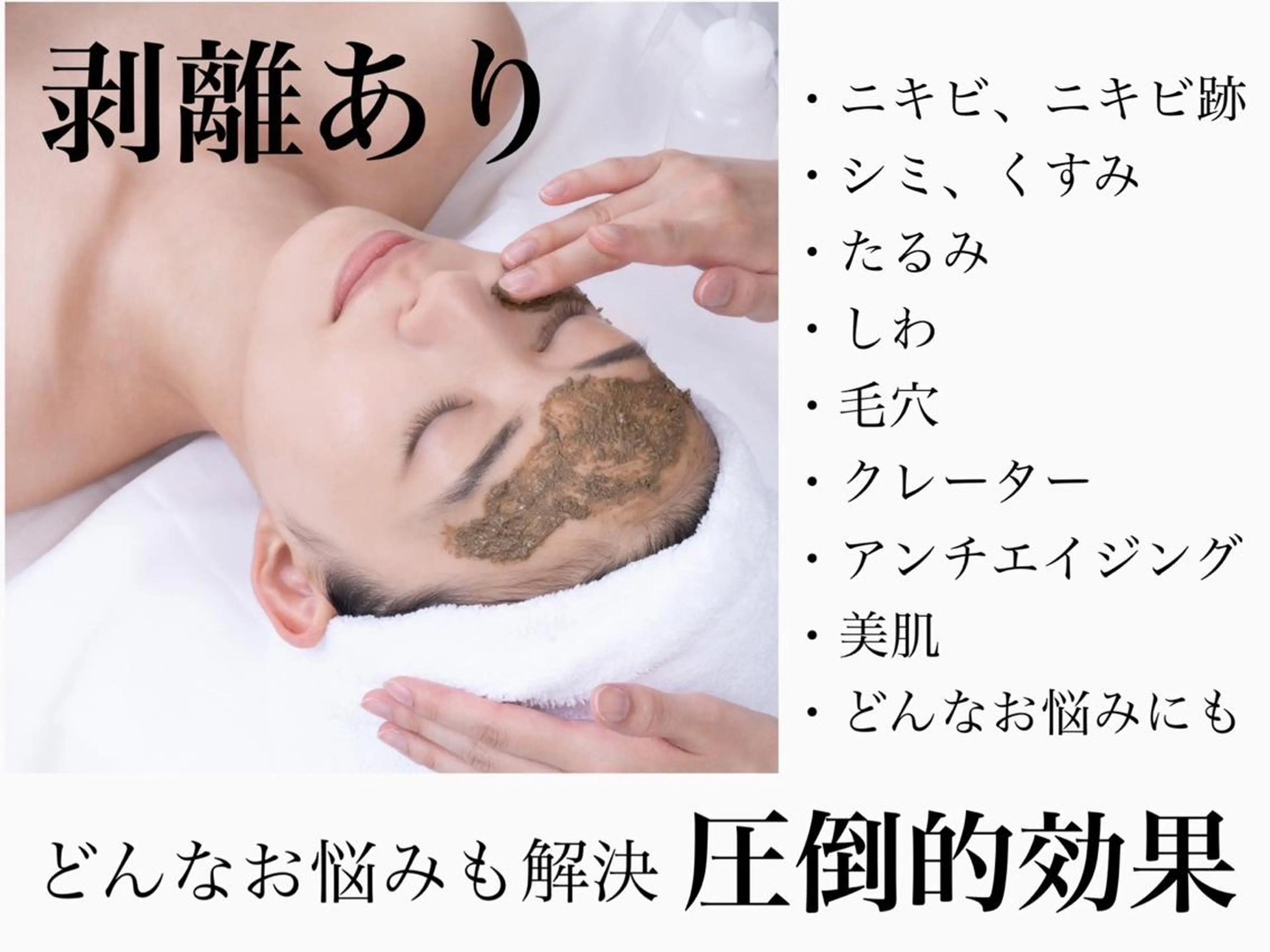 【頑固なニキビ・ニキビ跡・シワ】〈剥離あり〉リベルハーブピーリング🌿凸凹肌の改善や年齢肌、どんなお悩みにも◎の写真