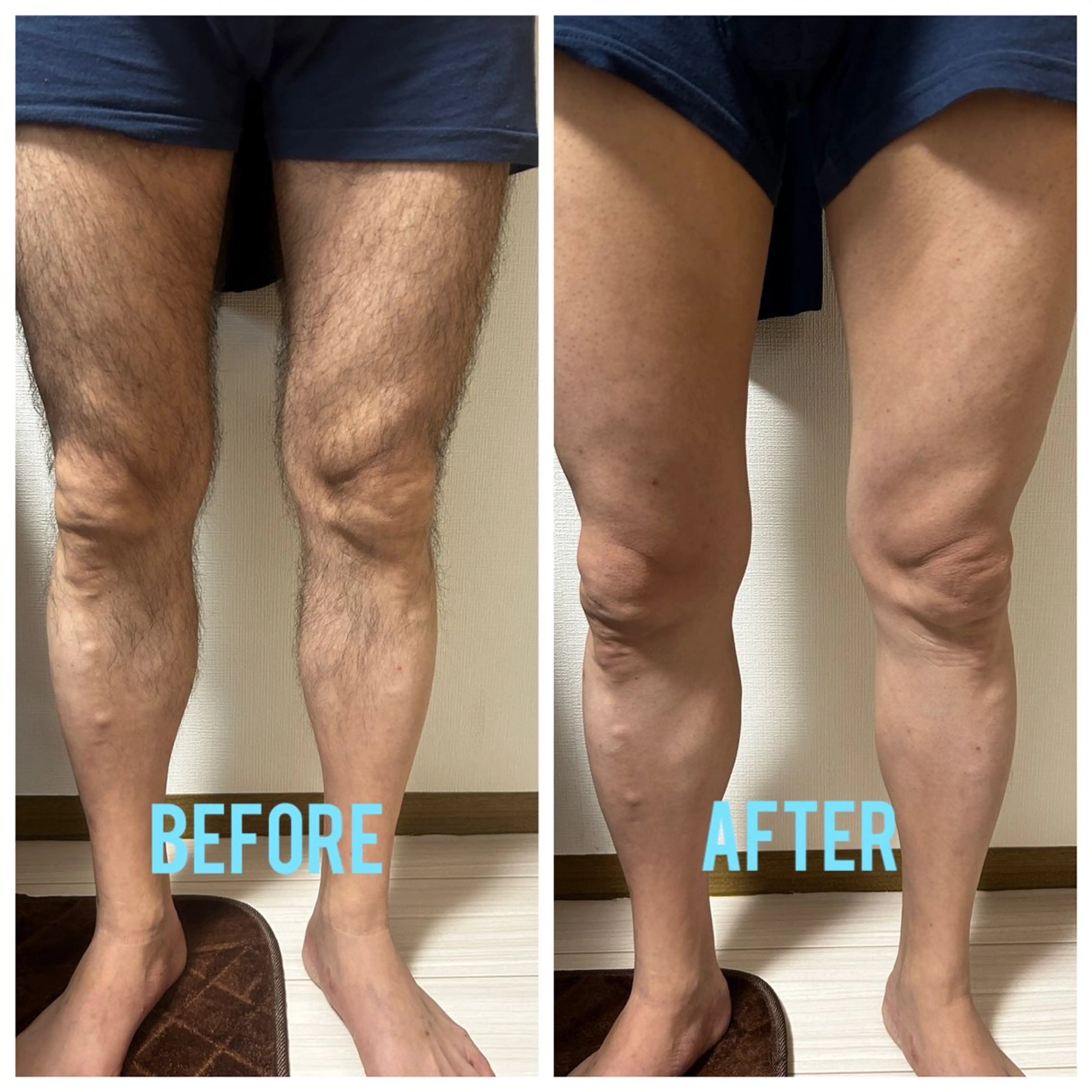 メンズ メンズ脱毛サロン shavys所属・shavys せいじのエステ・リラクイメージ