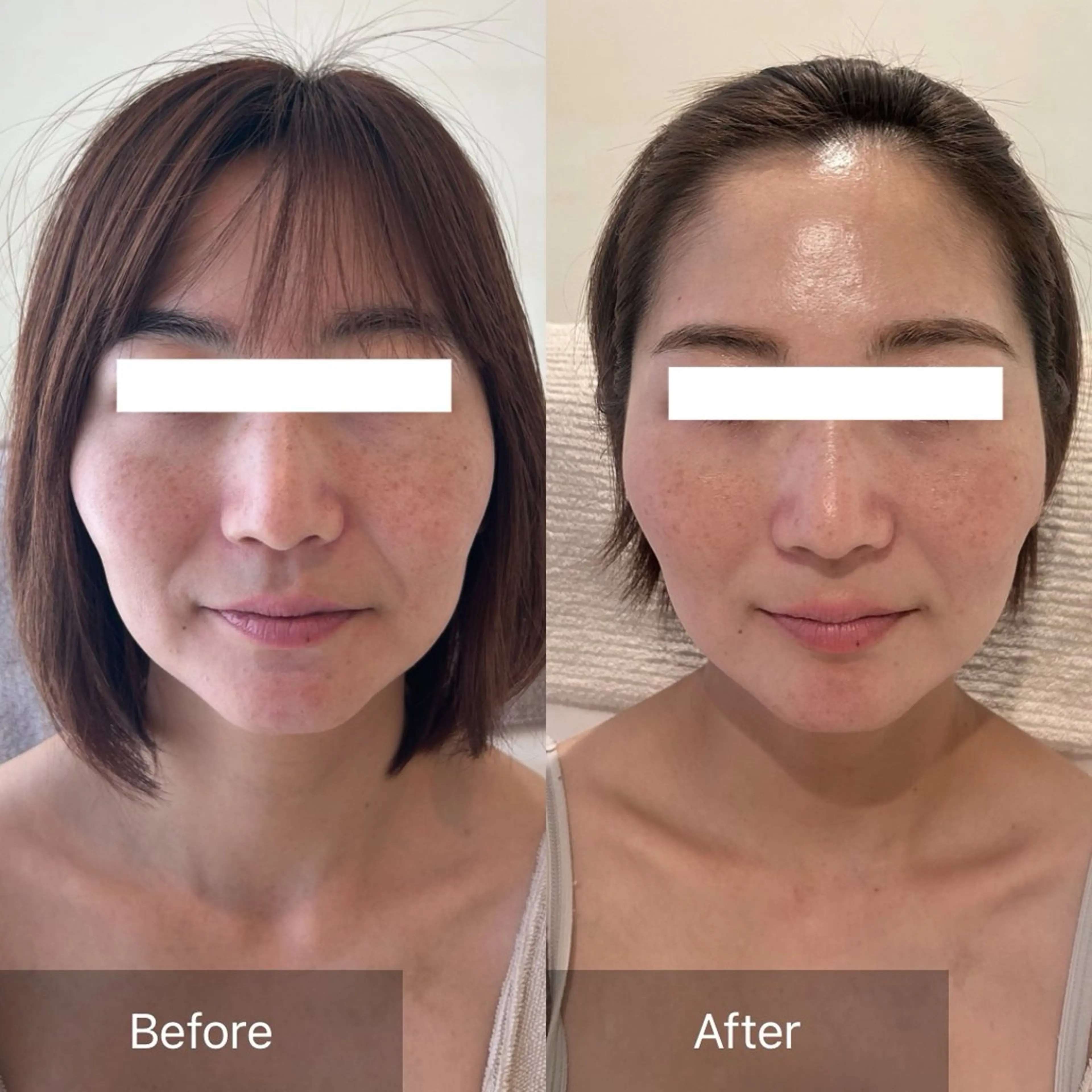 エステ Charis エステ&ネイルのエステ・リラクイメージ