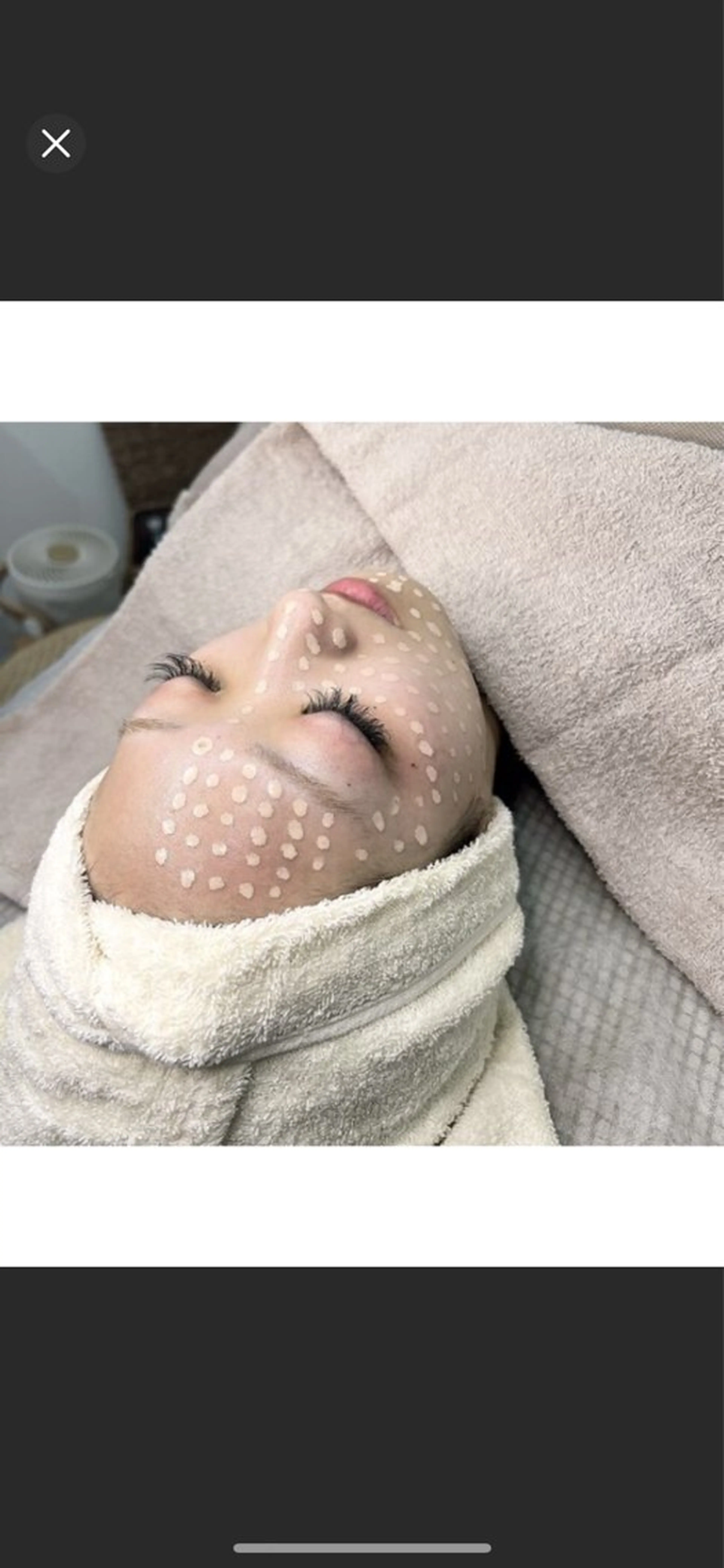 [高知初施術、ファンデーションいらい時代へ🤞🏻]メソスキンカラー🌈の写真