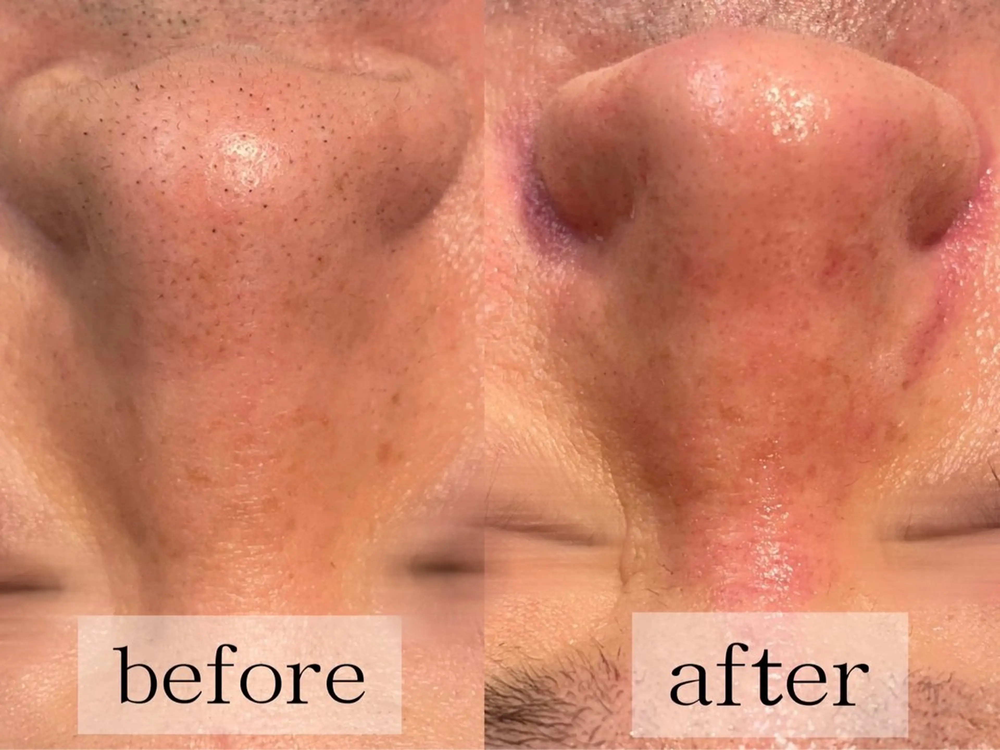 毛穴・肌質ケア専門 グランビューティーのエステ・リラクイメージ