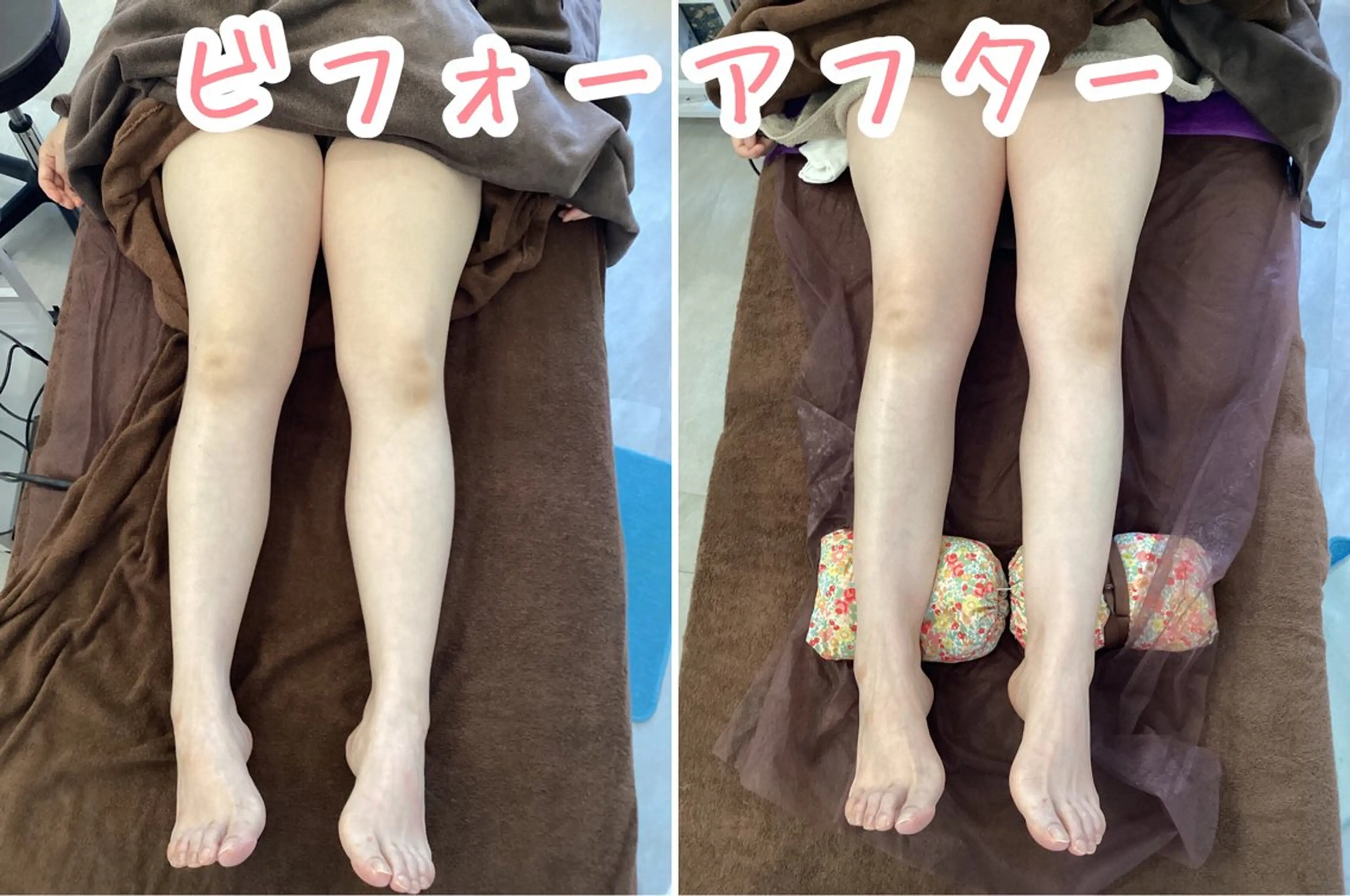 さくらんぼ鍼灸院所属・美容鍼&温活・免活 さくらんぼ鍼灸院のエステ・リラクイメージ