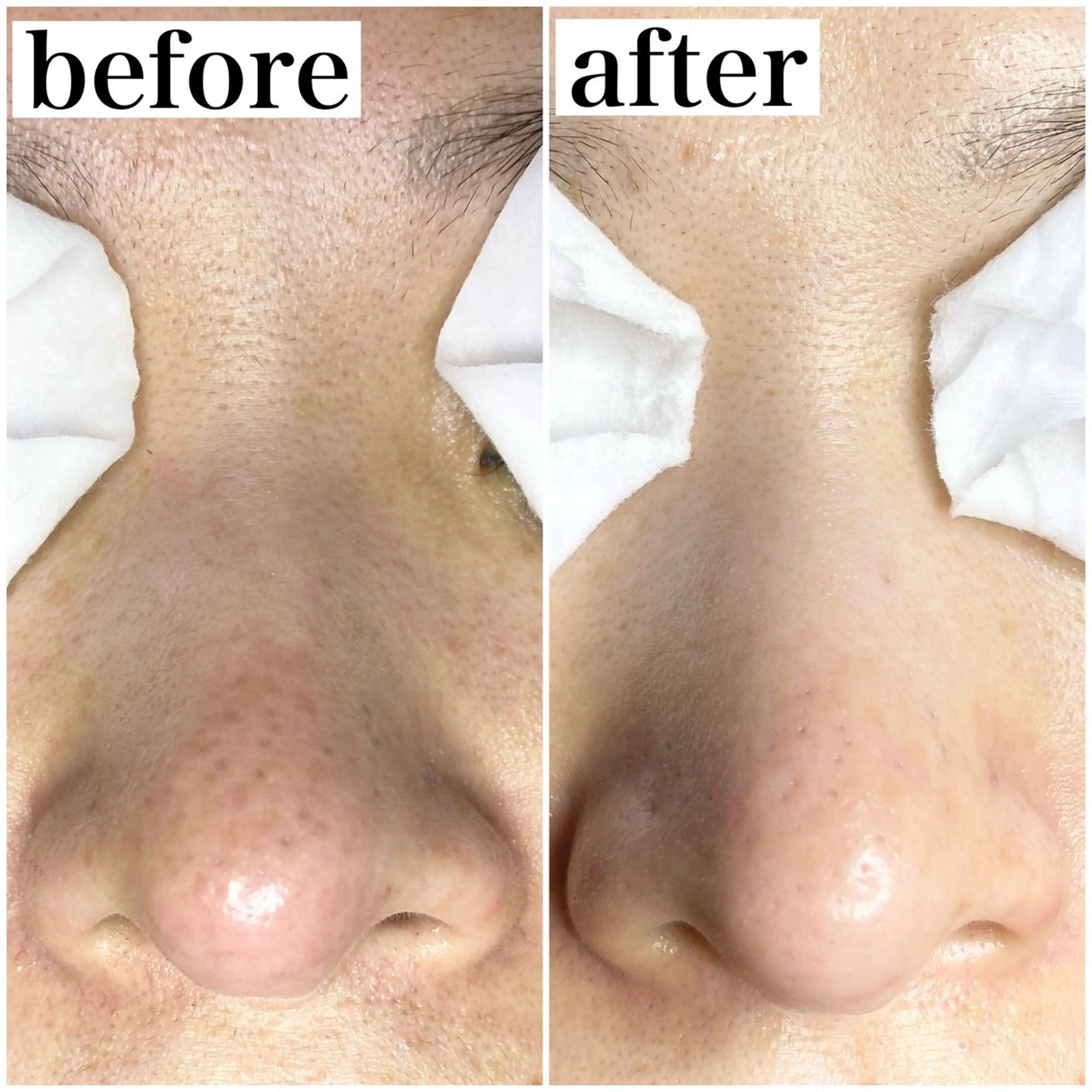 撮影モデル haruka .tのその他イメージ