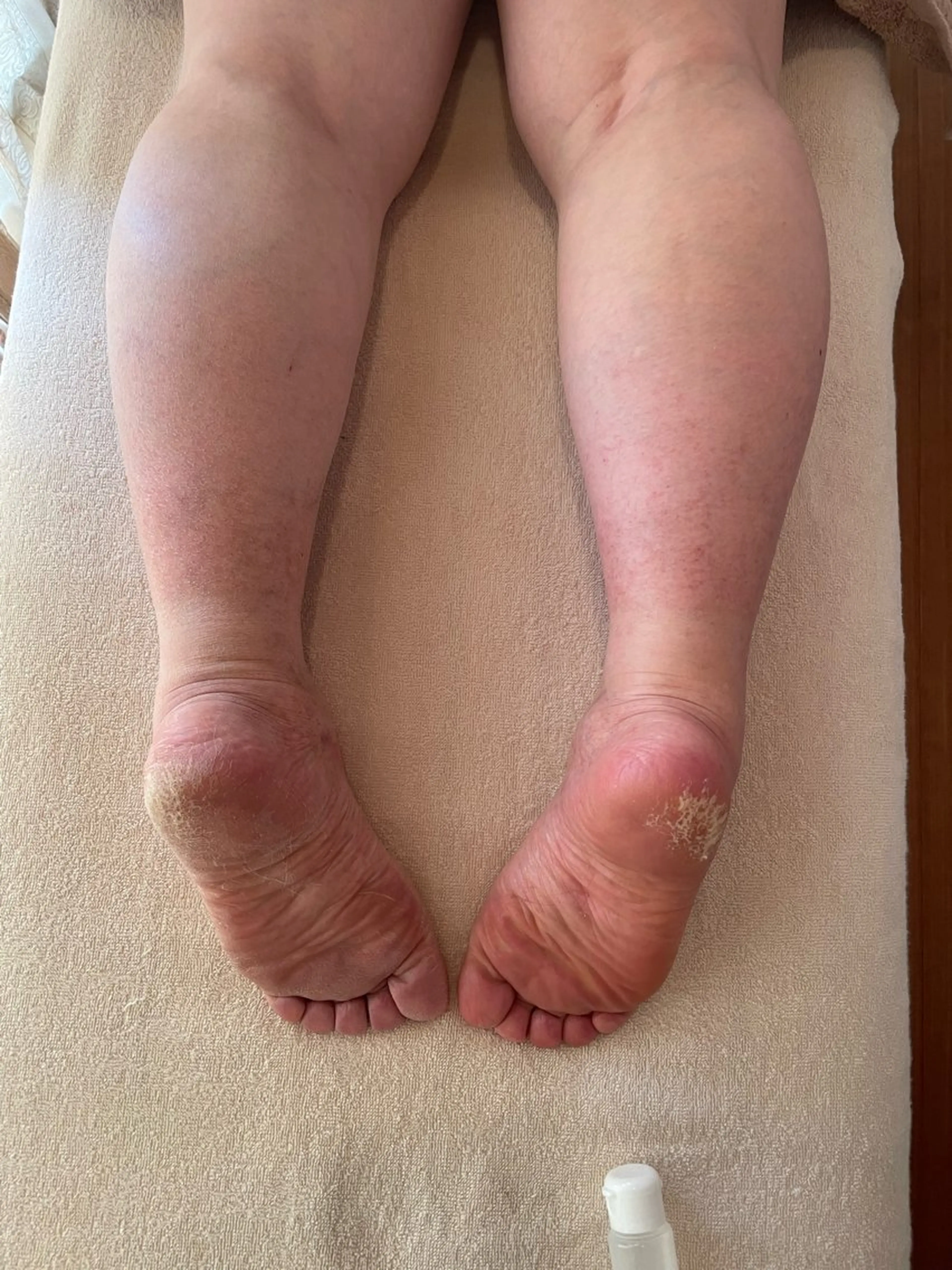 エステ Freesia total beauty所属・熊谷 かおりのエステ・リラクイメージ