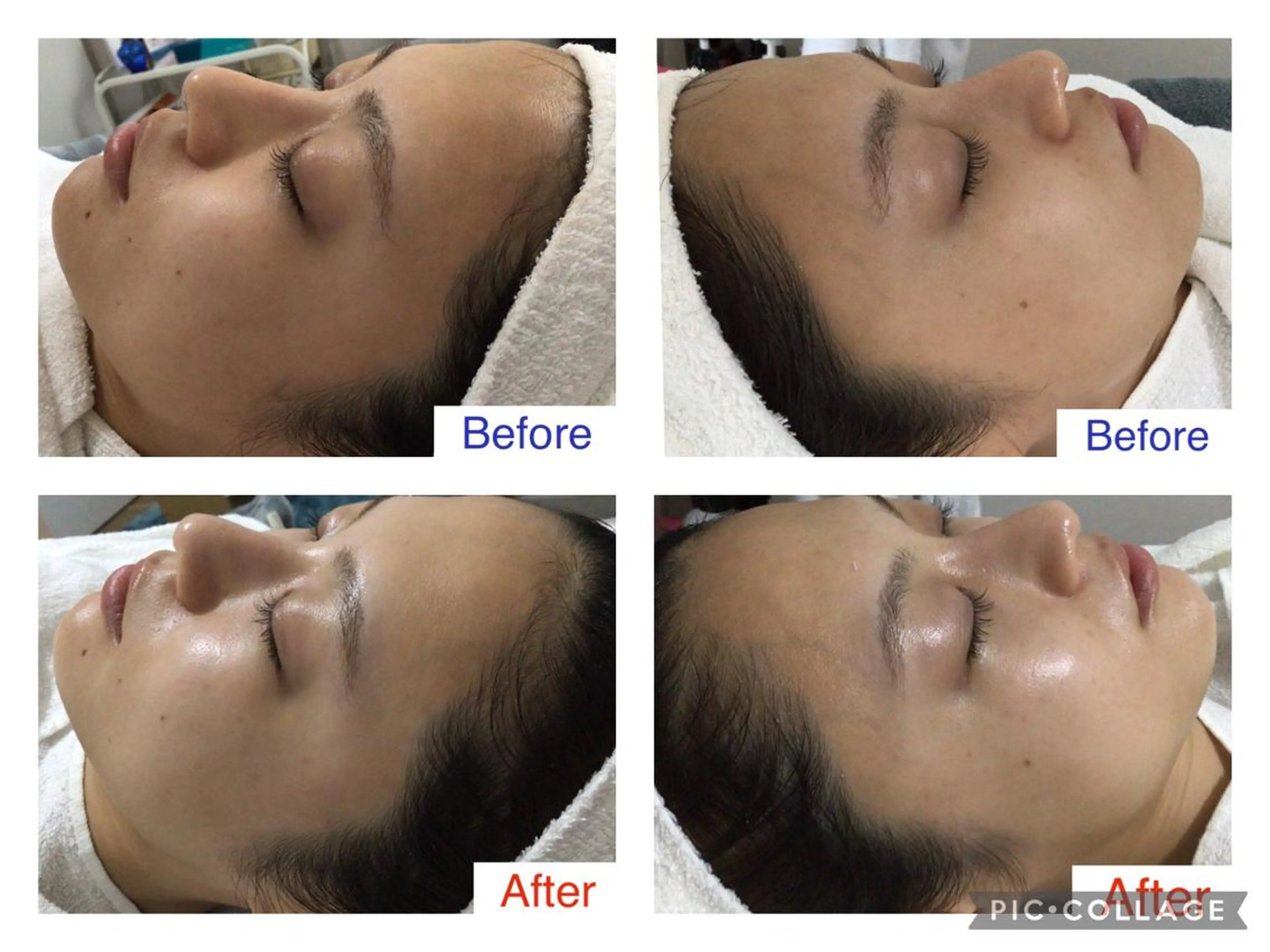 子宮矯正/腸揉み/ シュガーリング脱毛のエステ・リラクイメージ