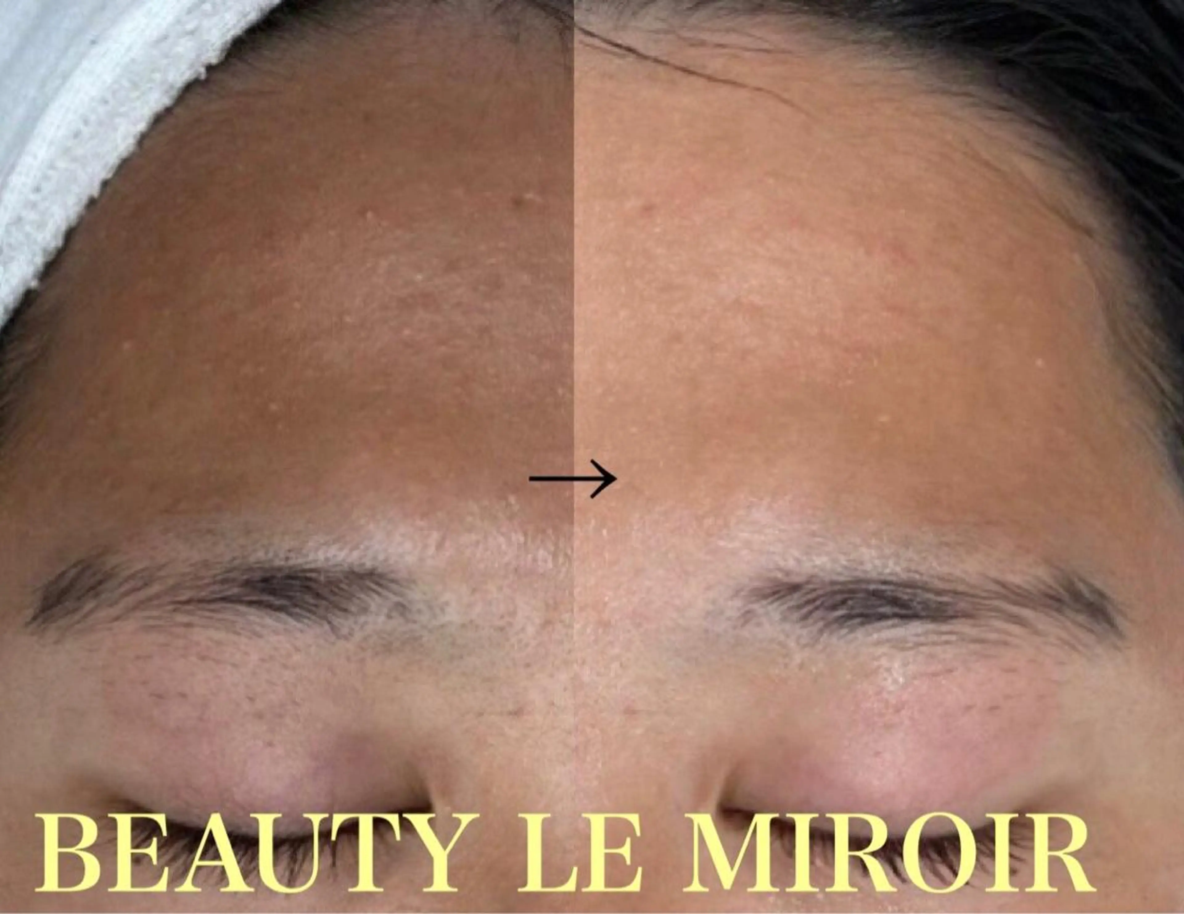 ビューティー ミロワールのエステ・リラクイメージ