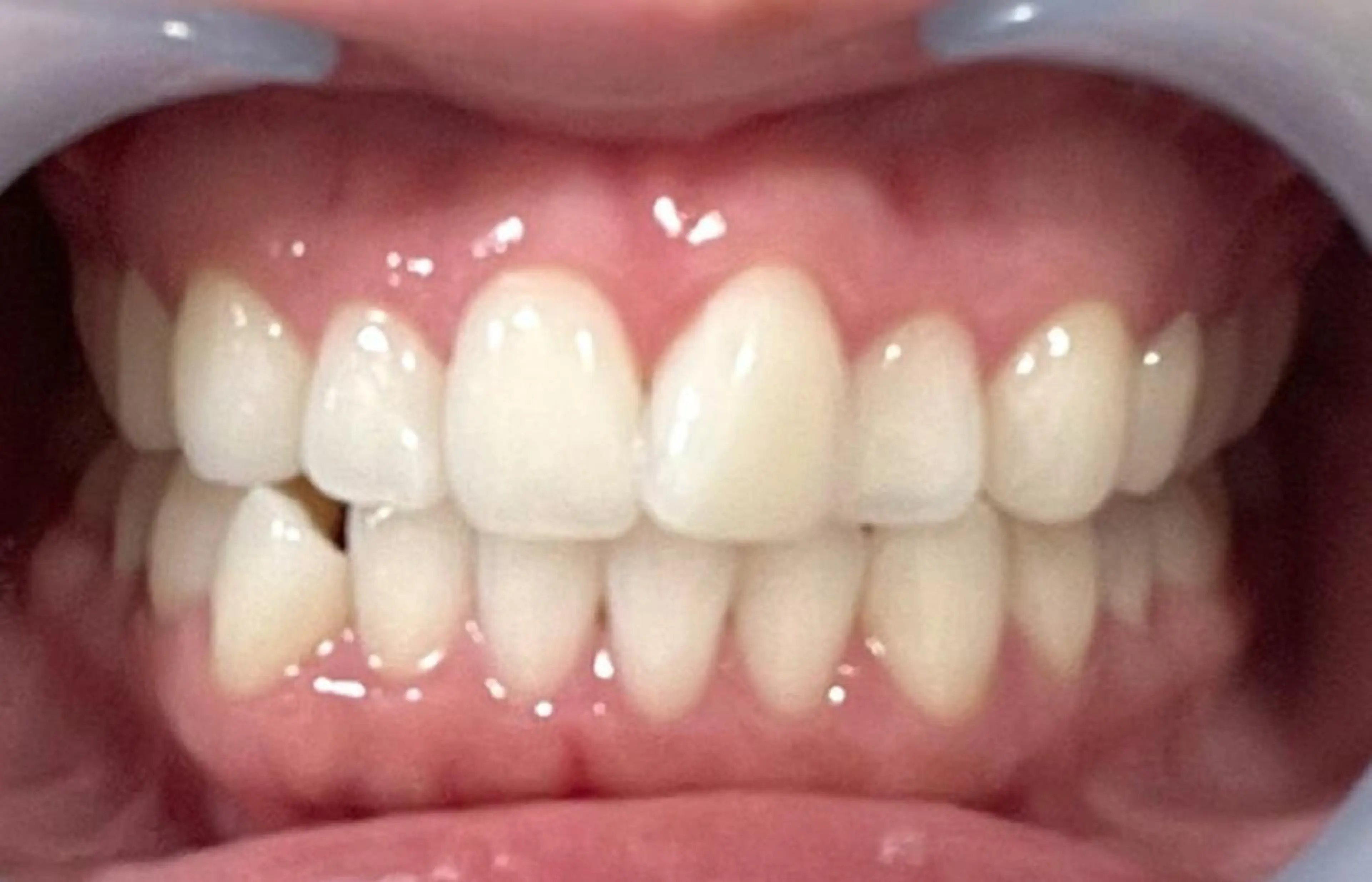 その他 五十嵐 蓮のその他イメージ