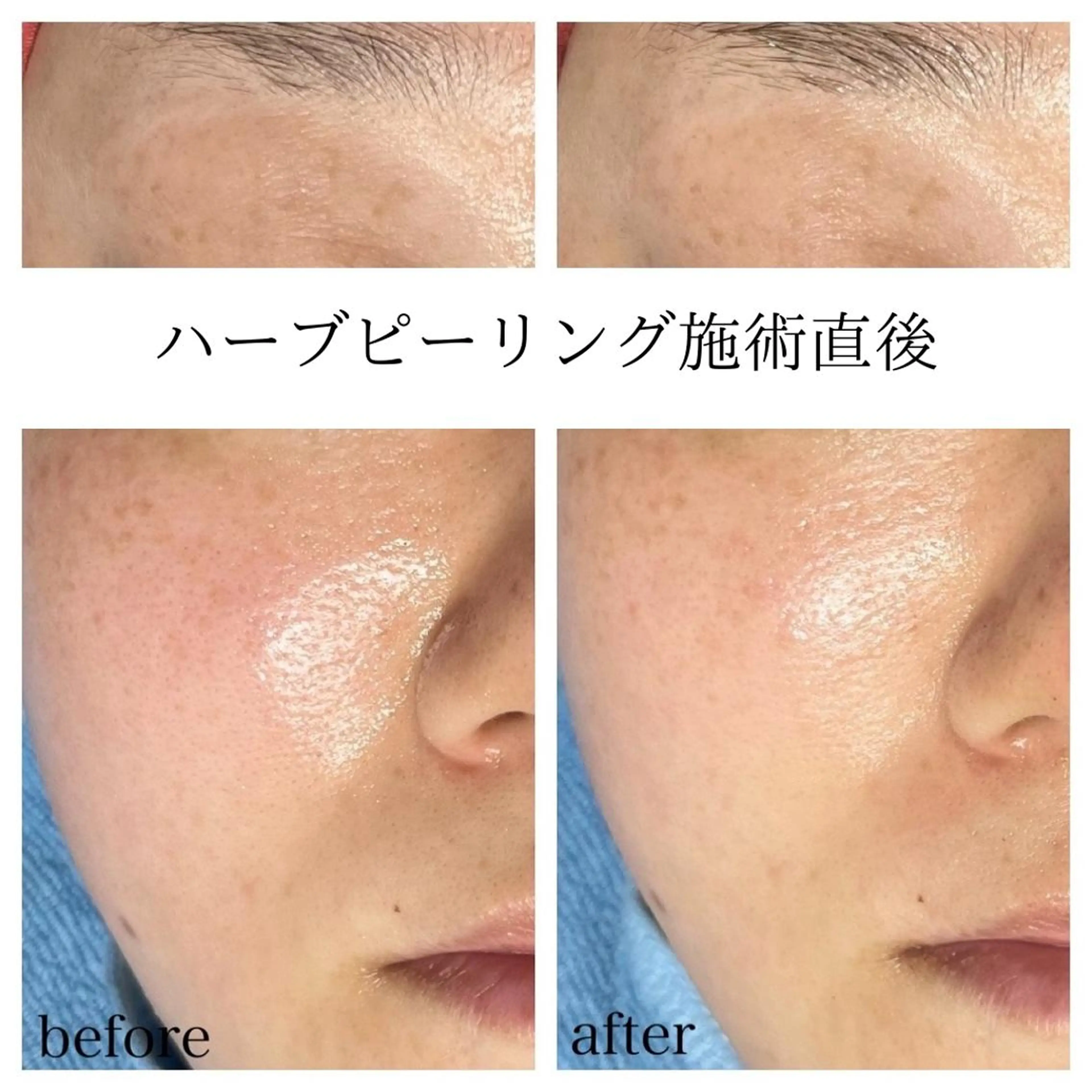 エステ kapua所属・Kapua🌺 マユのマツエク・マツパデザイン