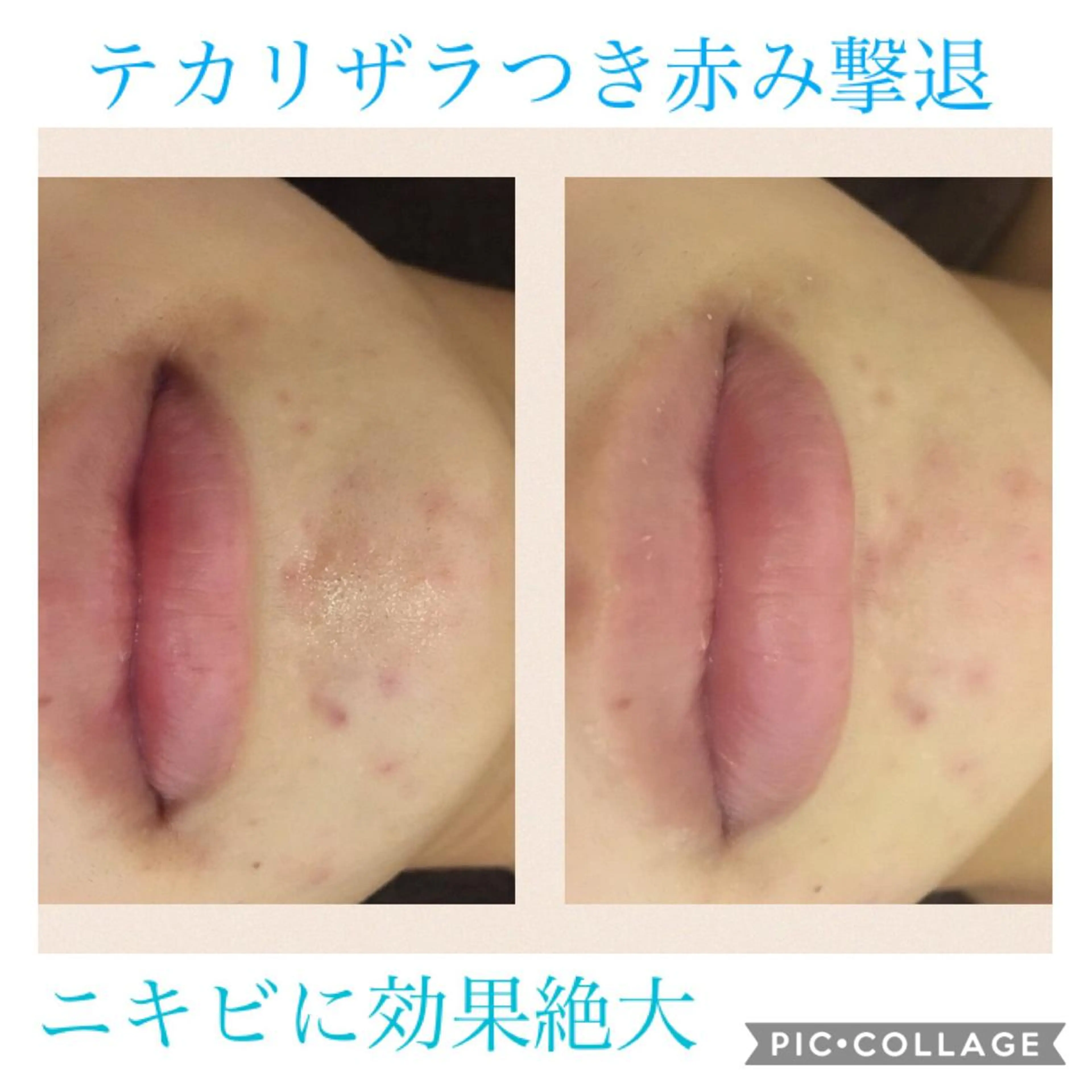 ミディアム カラー パーマ ヘアアレンジ キッズ ネイル マツエク・マツパ エステ リラク Ensor Clair所属・EnsorClair 代表　野口真央のエステ・リラクイメージ