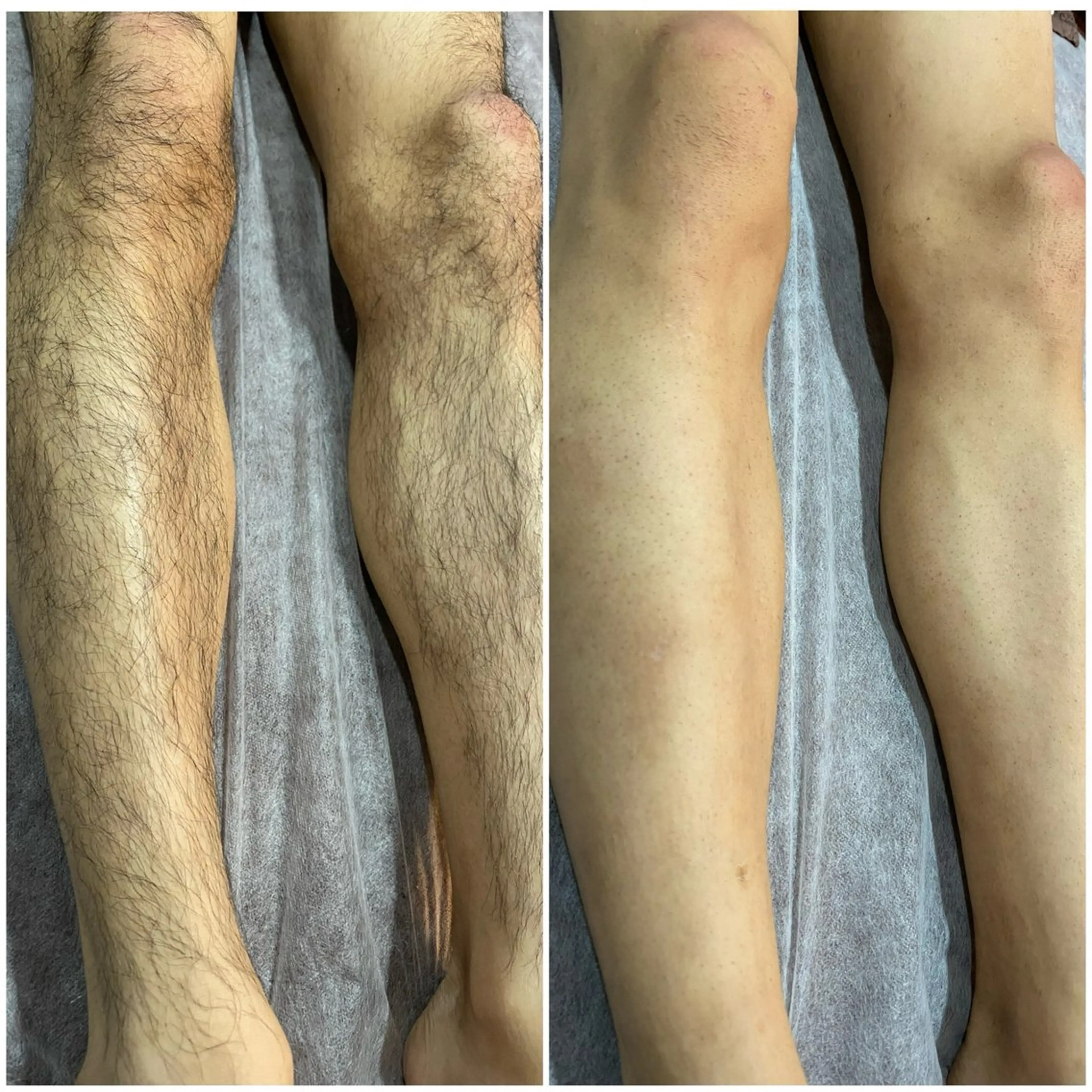 脱毛専門サロンElixir加須店所属・脱毛専門サロン Elixir　加須店のエステ・リラクイメージ