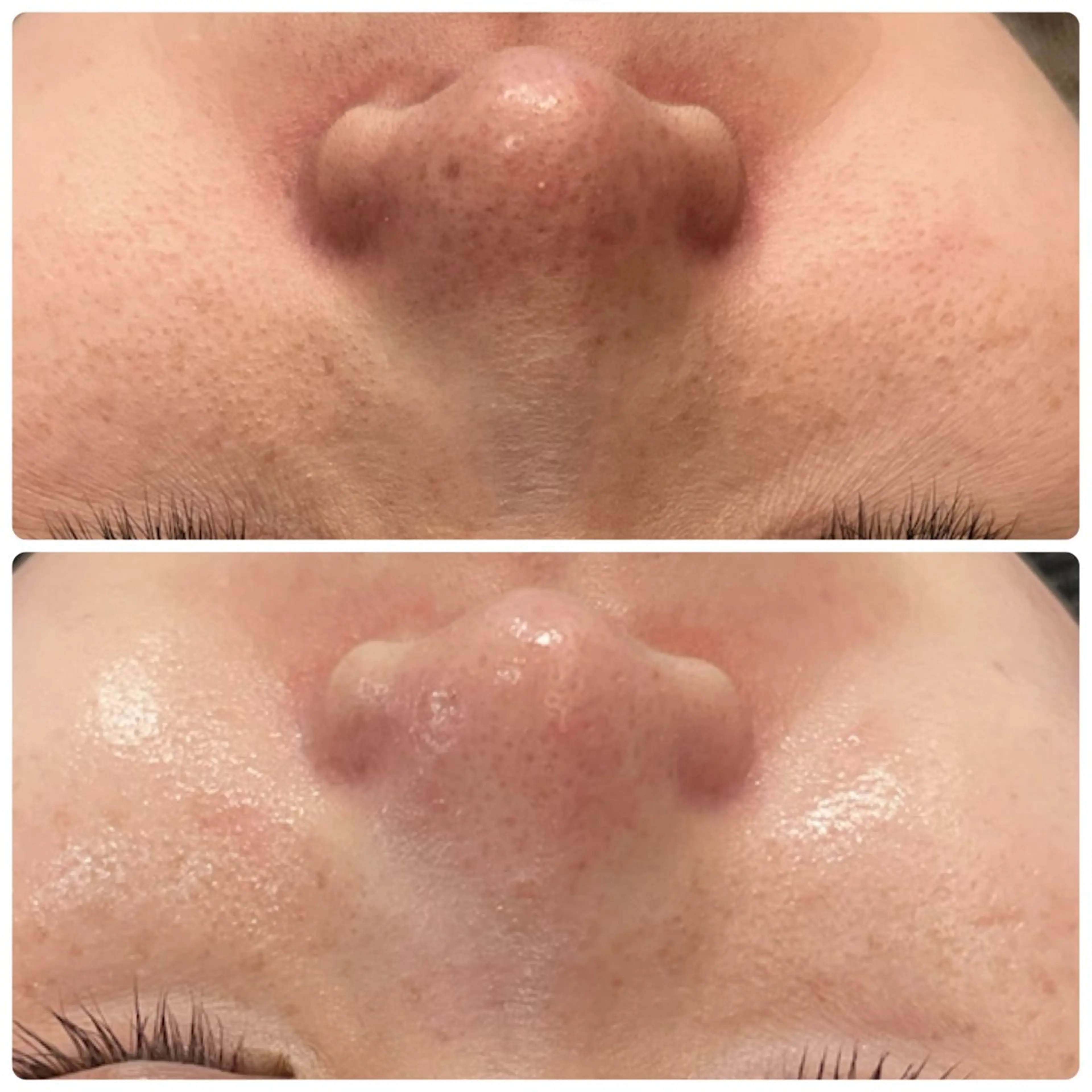 エステ yellow.所属・yellow💛【 脱毛&フェイシャル】のエステ・リラクイメージ