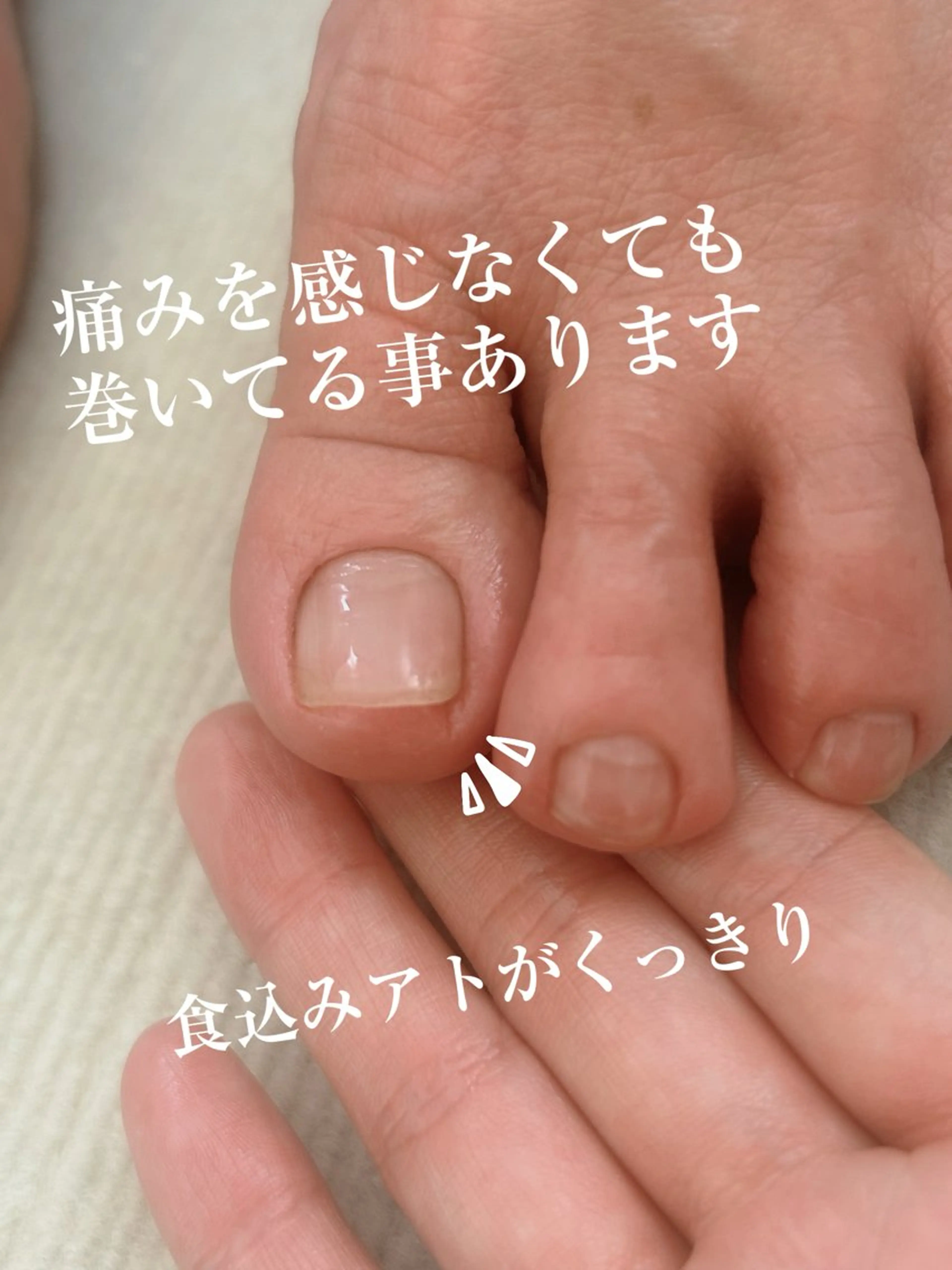 その他 巻き爪フットケアサロンKotori所属・フットケアサロン Kotoriのその他イメージ