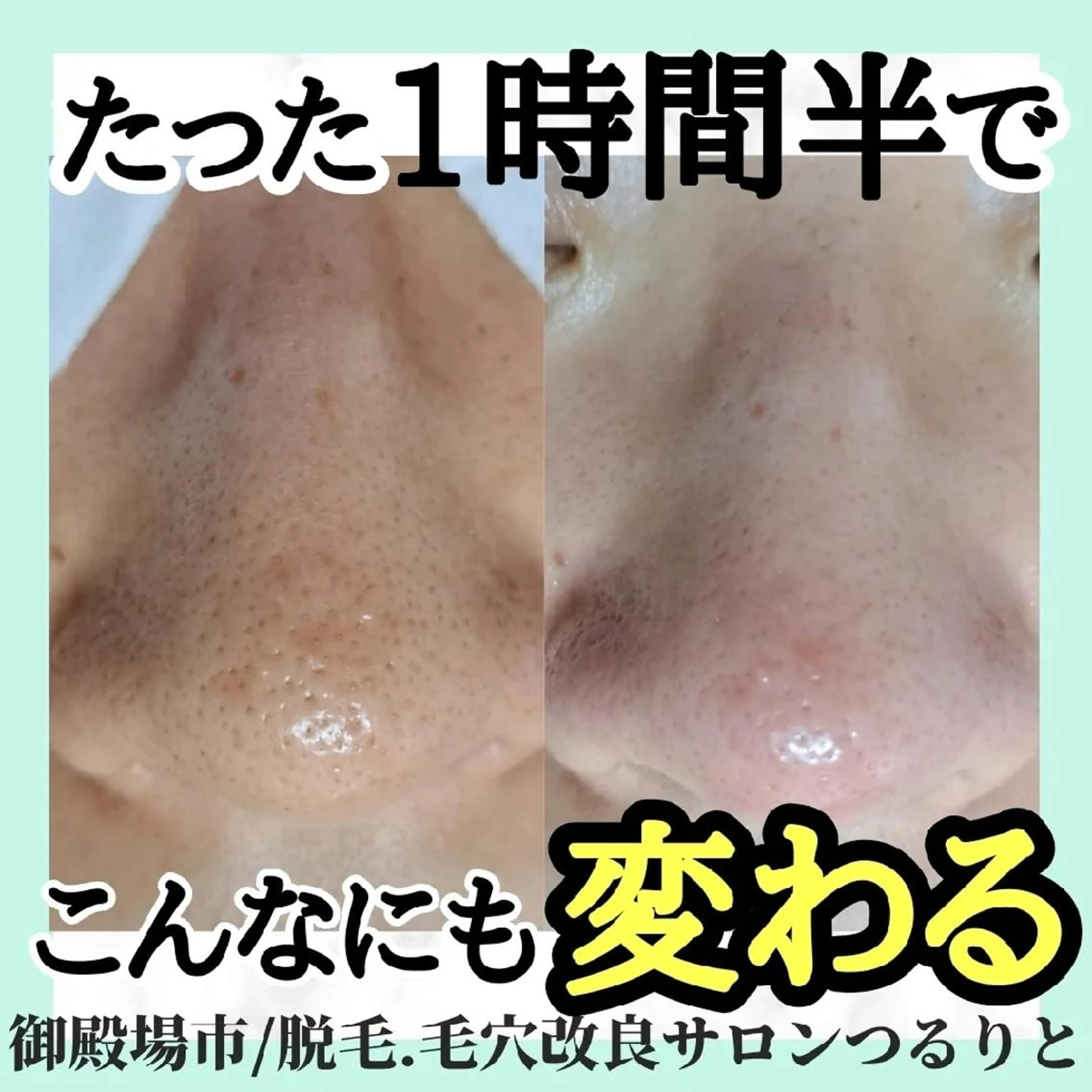 エステ リラク 美肌脱毛サロン つるりと御殿場店所属・美肌脱毛サロン つるりとのその他イメージ