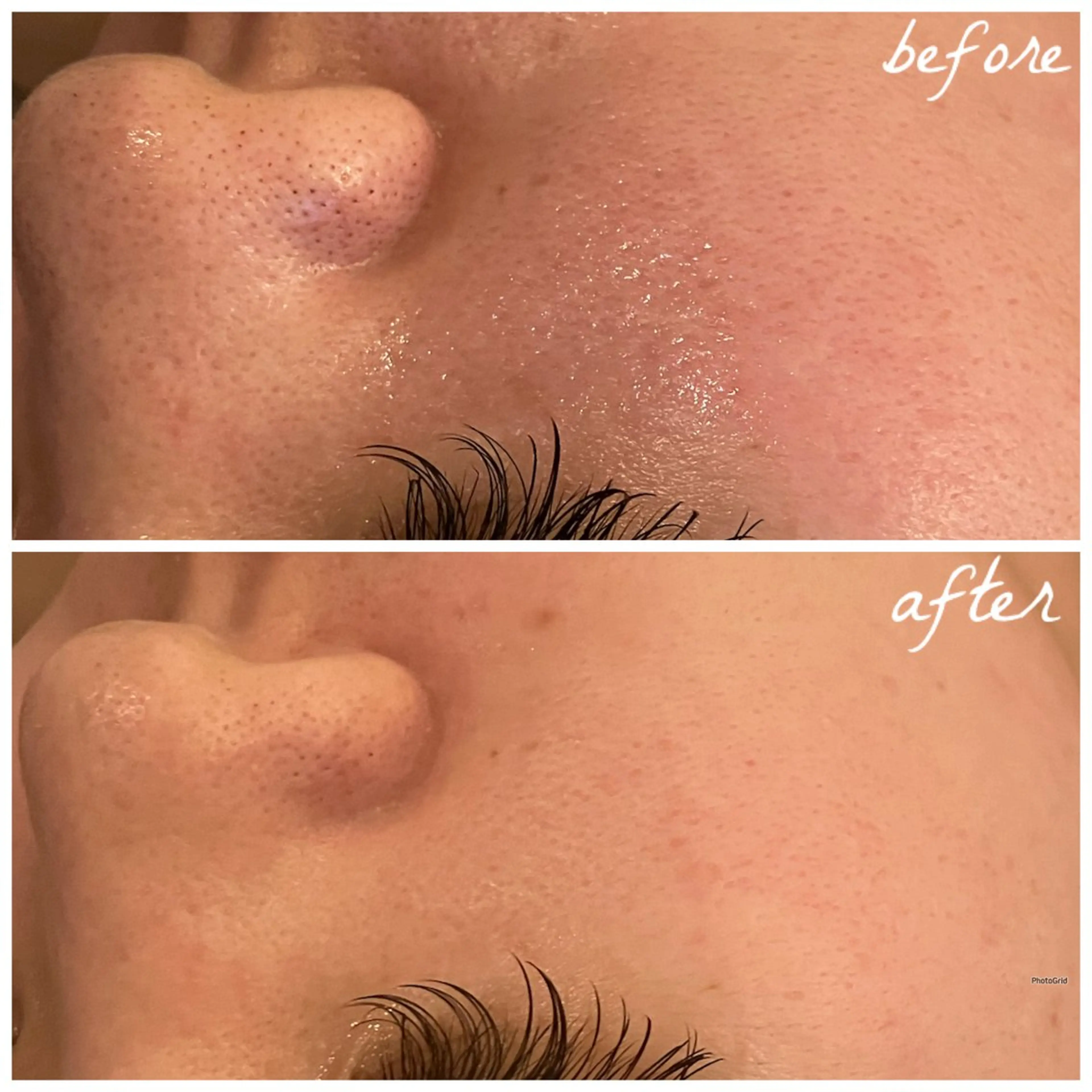 メンズ エステ メナード岐阜茜部 杉浦のエステ・リラクイメージ