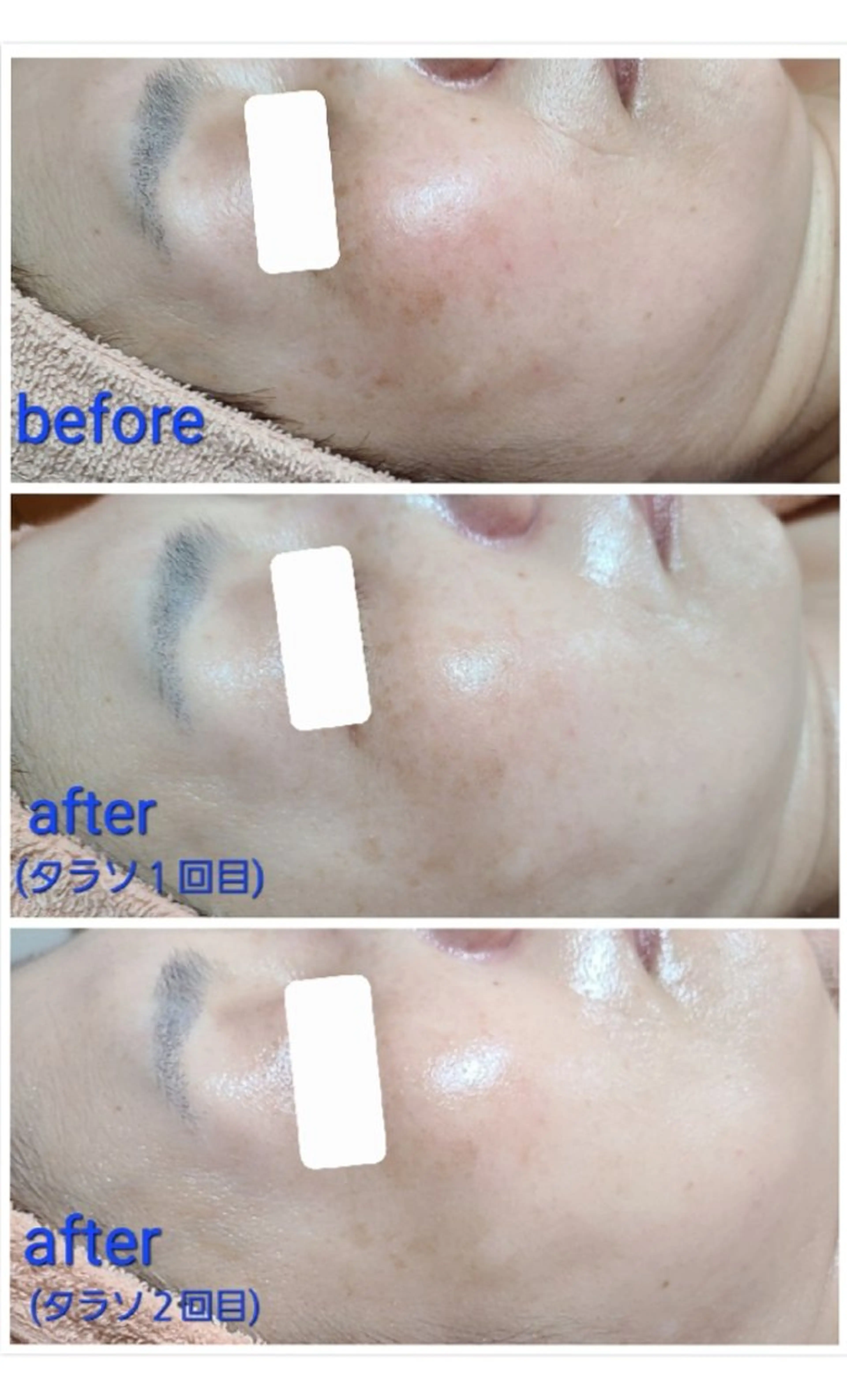 エステ 顔ツボ整顔セラピスト 三根百恵のエステ・リラクイメージ