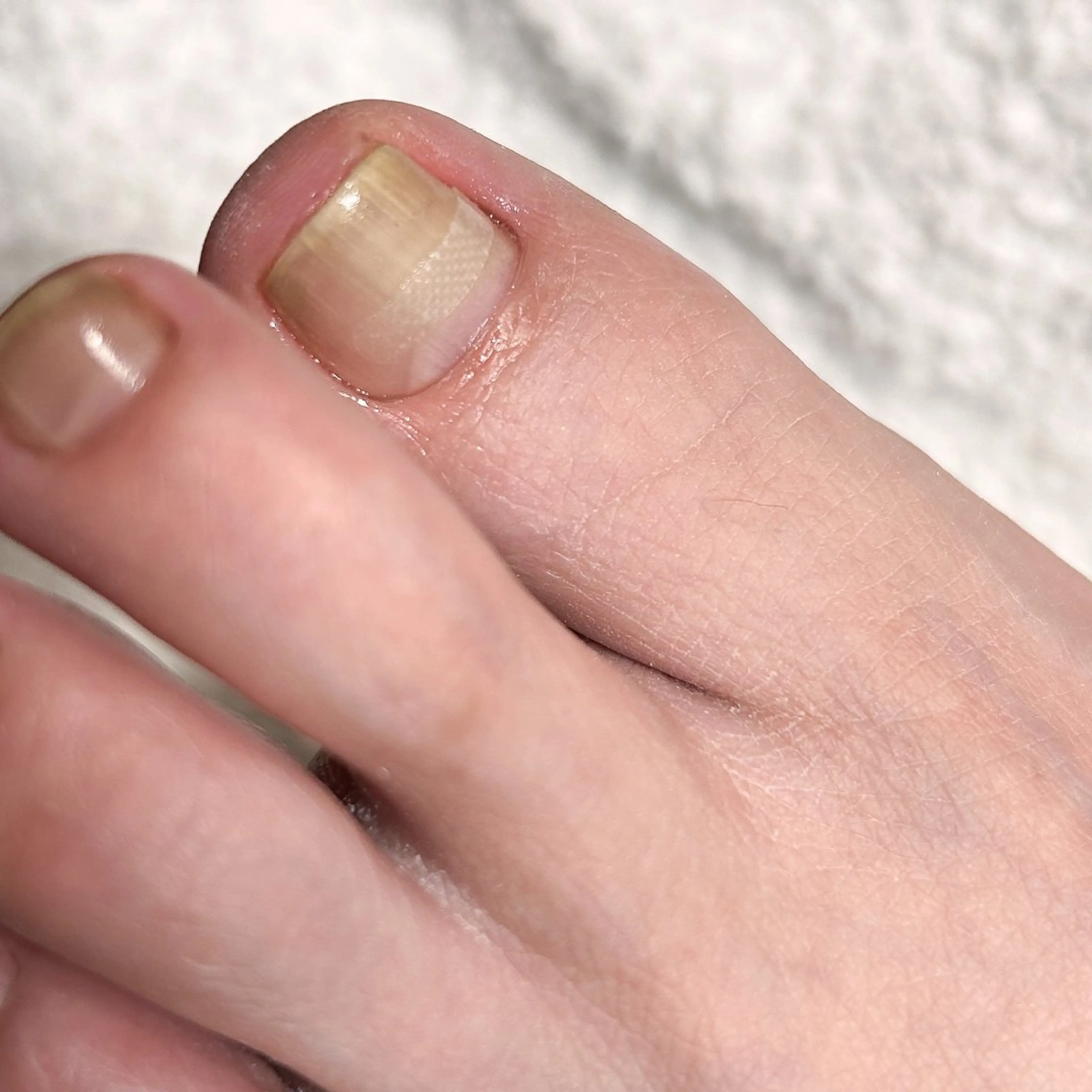 ネイル ケアが得意なサロン Happinailのエステ・リラクイメージ