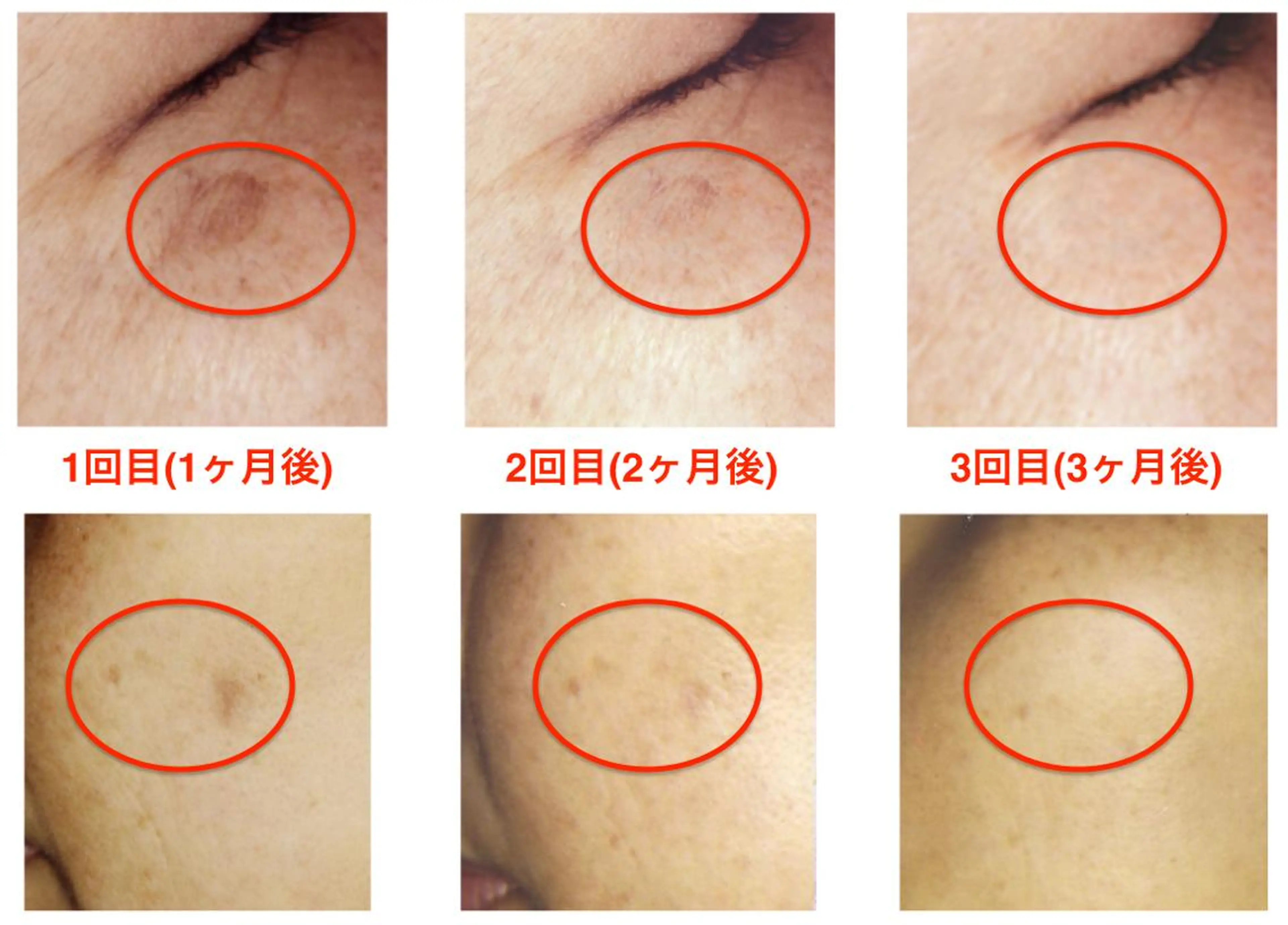 シミデトックスの写真