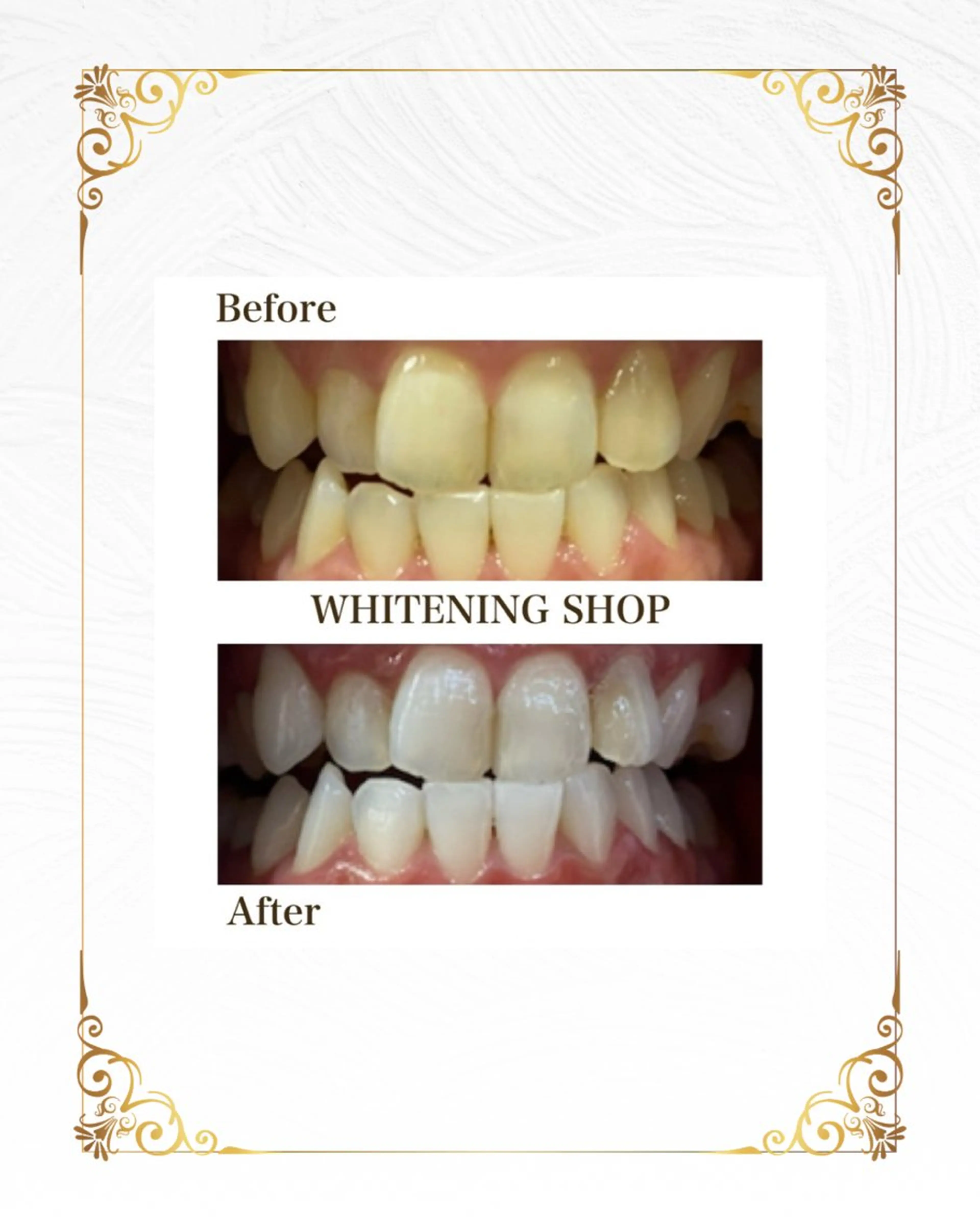 その他 ホワイトニングショップ静岡葵区店所属・ホワイトニング ショップ葵区静岡駅店のその他イメージ