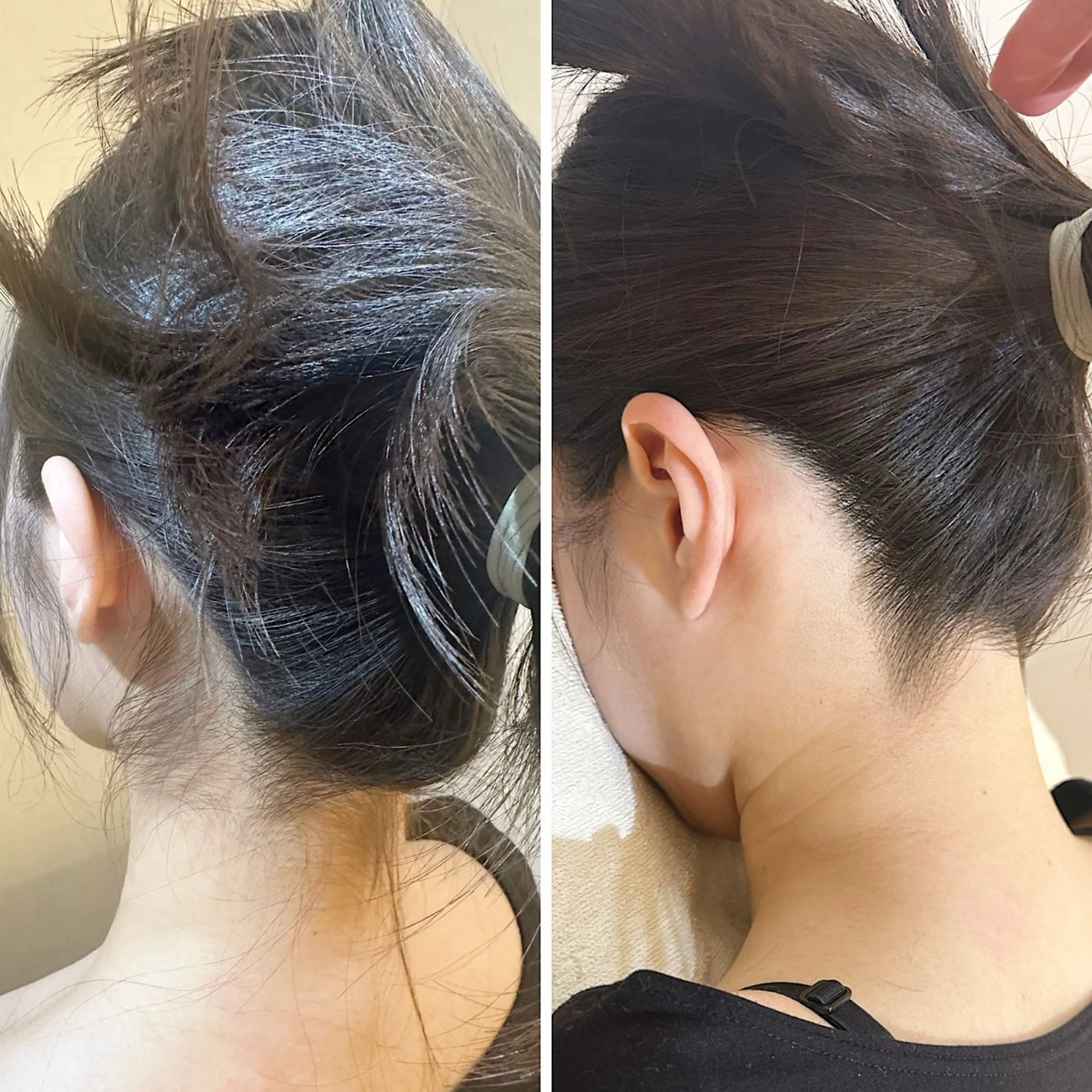 脱毛 うなじ脱毛/美肌脱毛 LABELのエステ・リラクイメージ