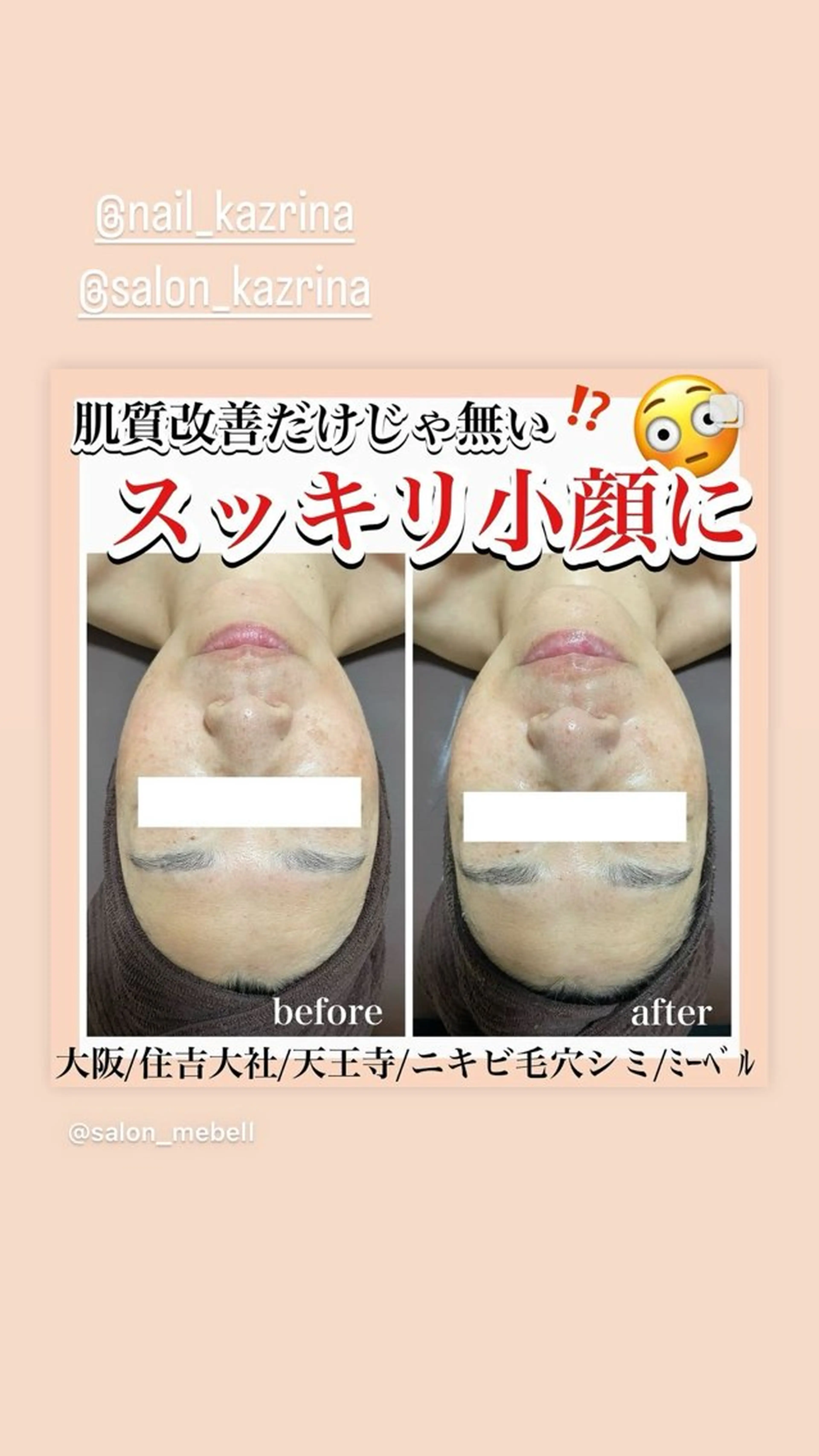 salon  mebell所属・肌管理専門店 mebell天王寺店のエステ・リラクイメージ