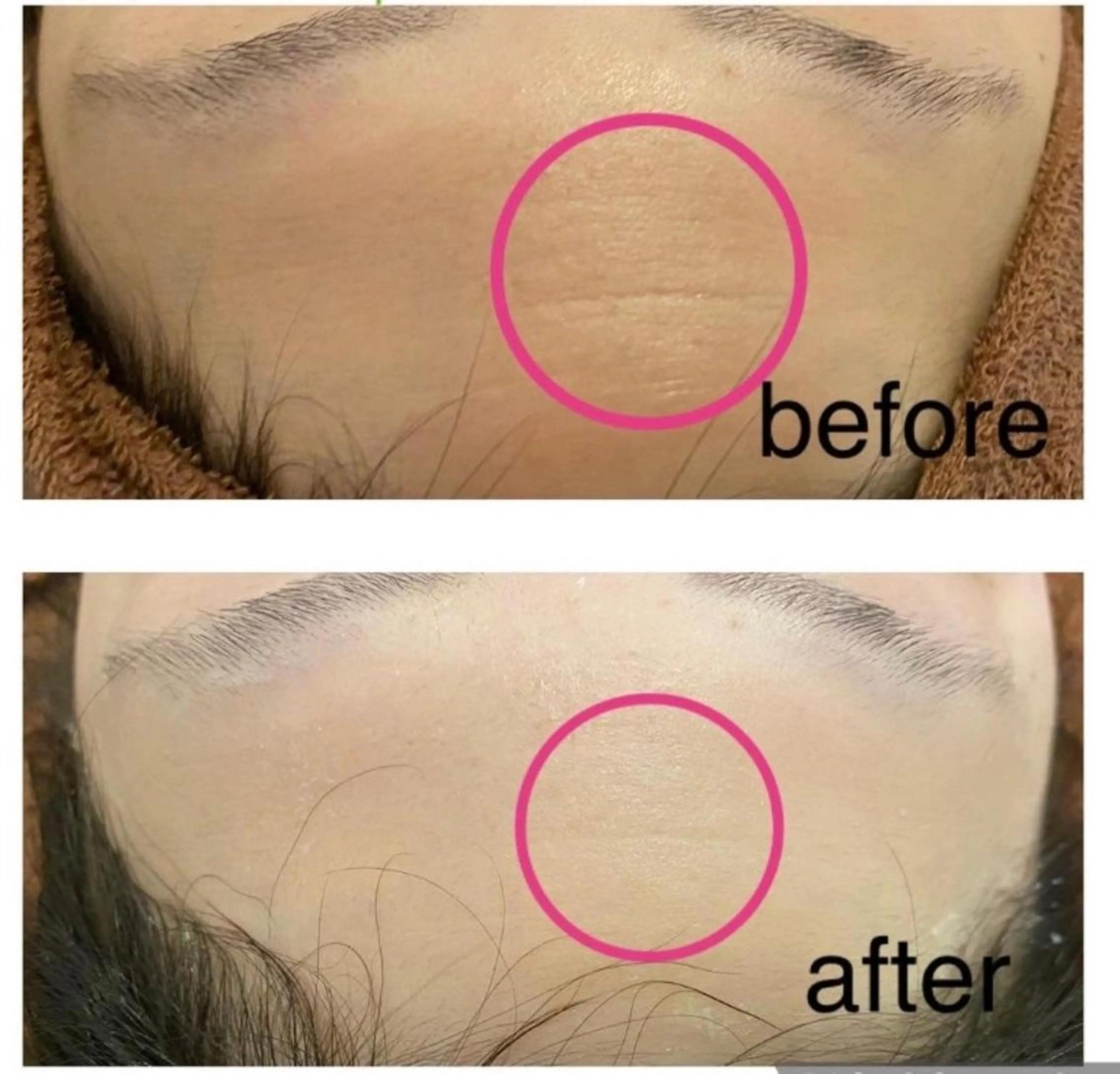 都内で出来る肌管理! 最短ニキビ改善のエステ・リラクイメージ