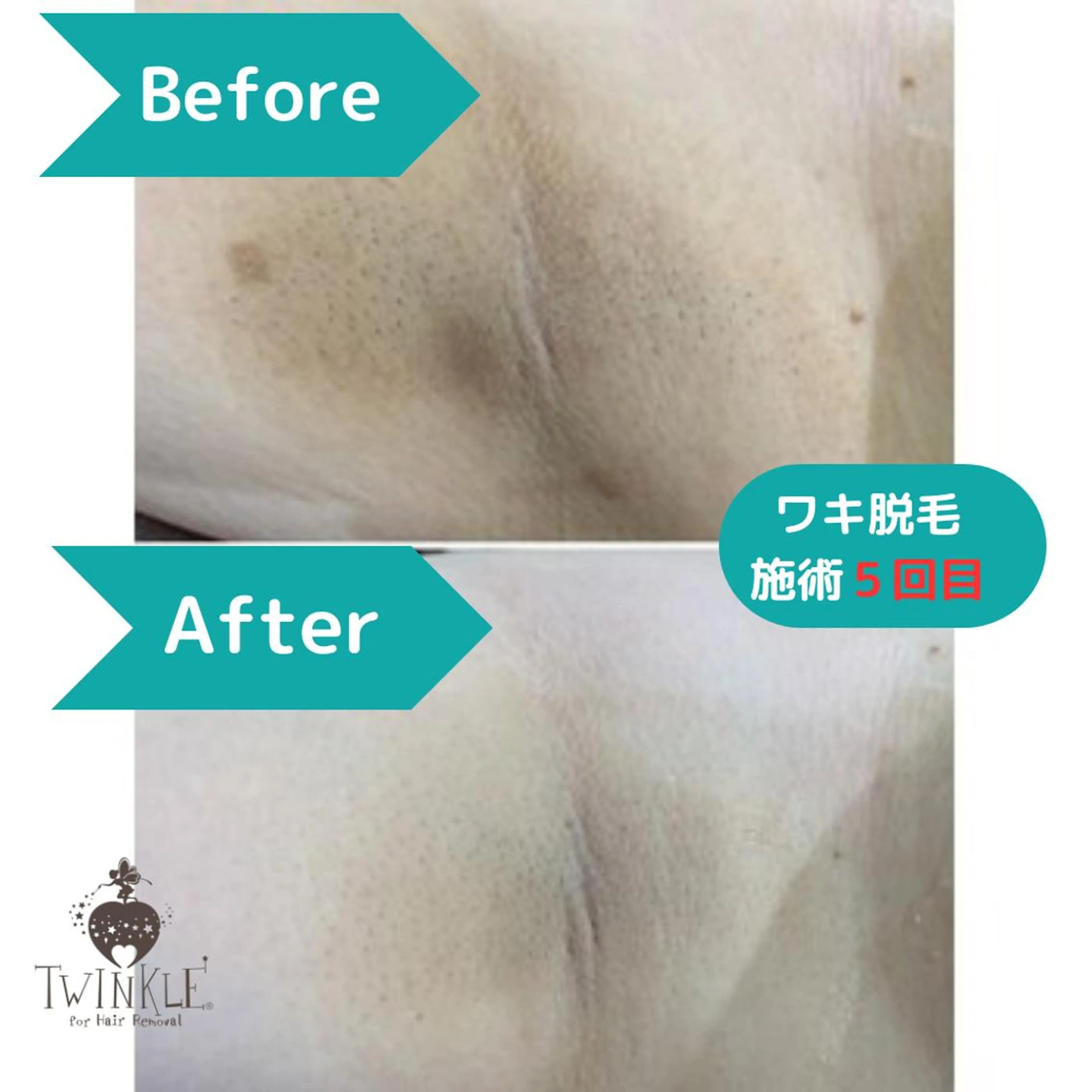 TWINKLE上尾店 Shimadaのエステ・リラクイメージ