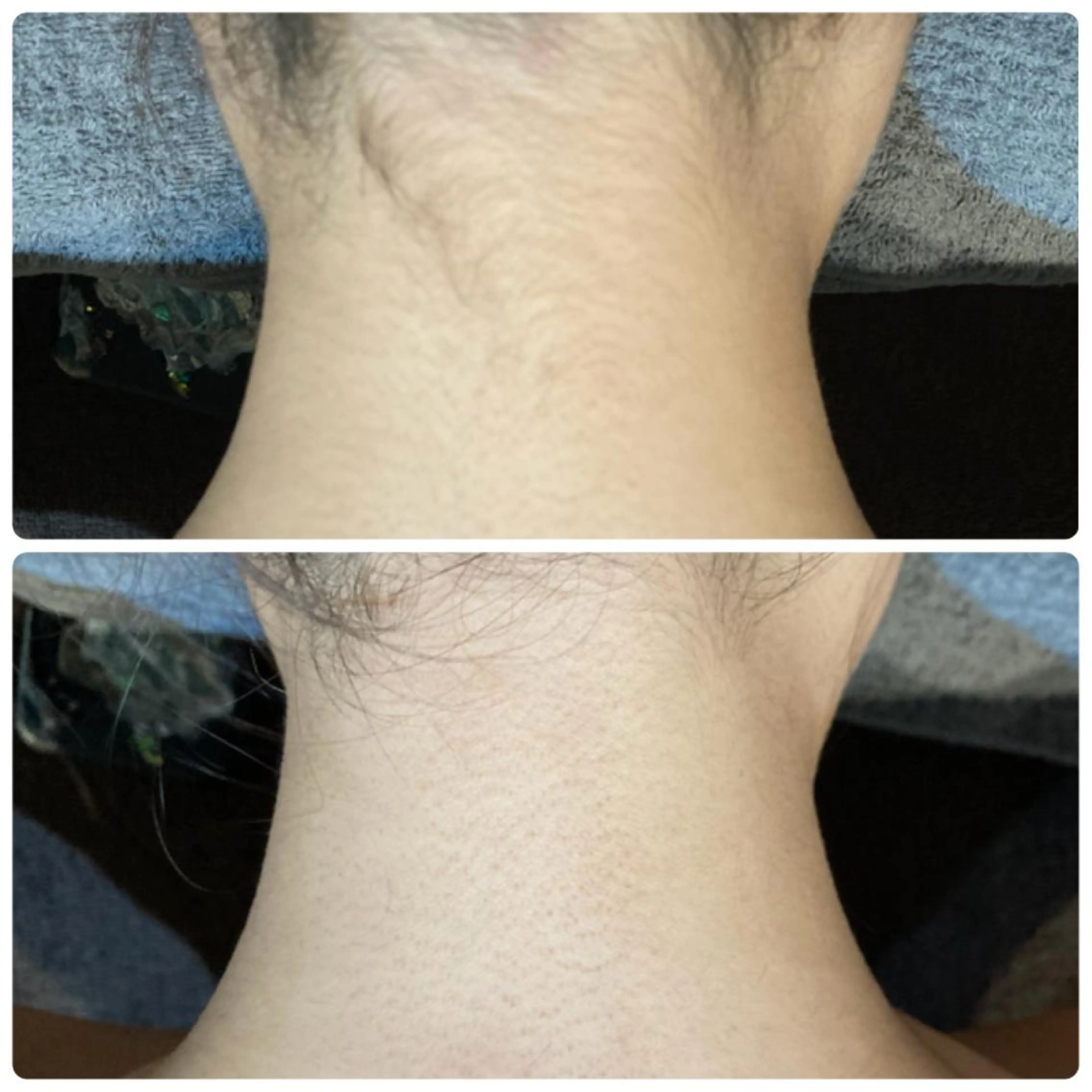 メンズ&レディース美容脱毛専門LEPIAつくば店所属・廣木 麻衣子のエステ・リラクイメージ