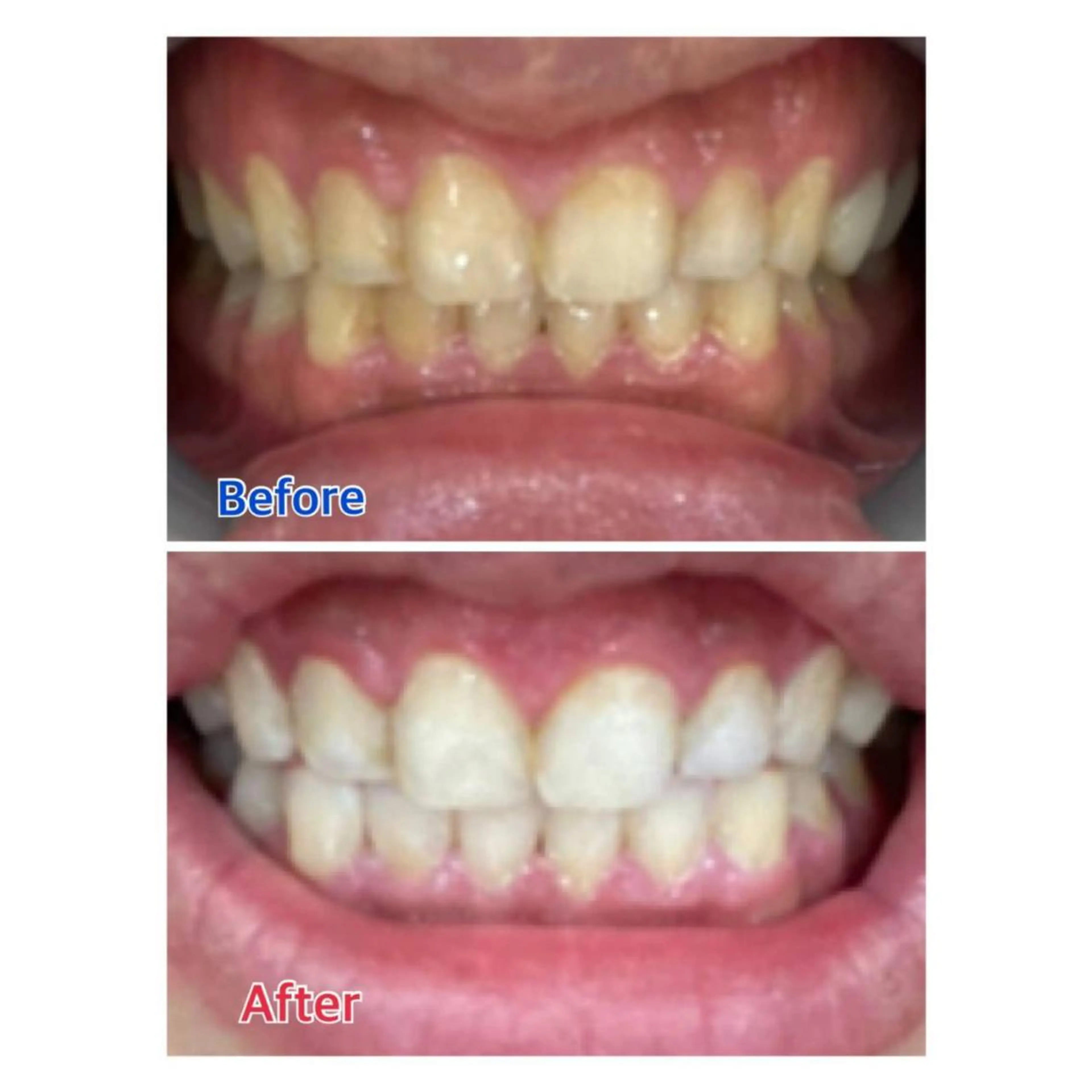 MBEAUTYSALON 千葉店・京成大久保所属・Melty 輝のその他イメージ