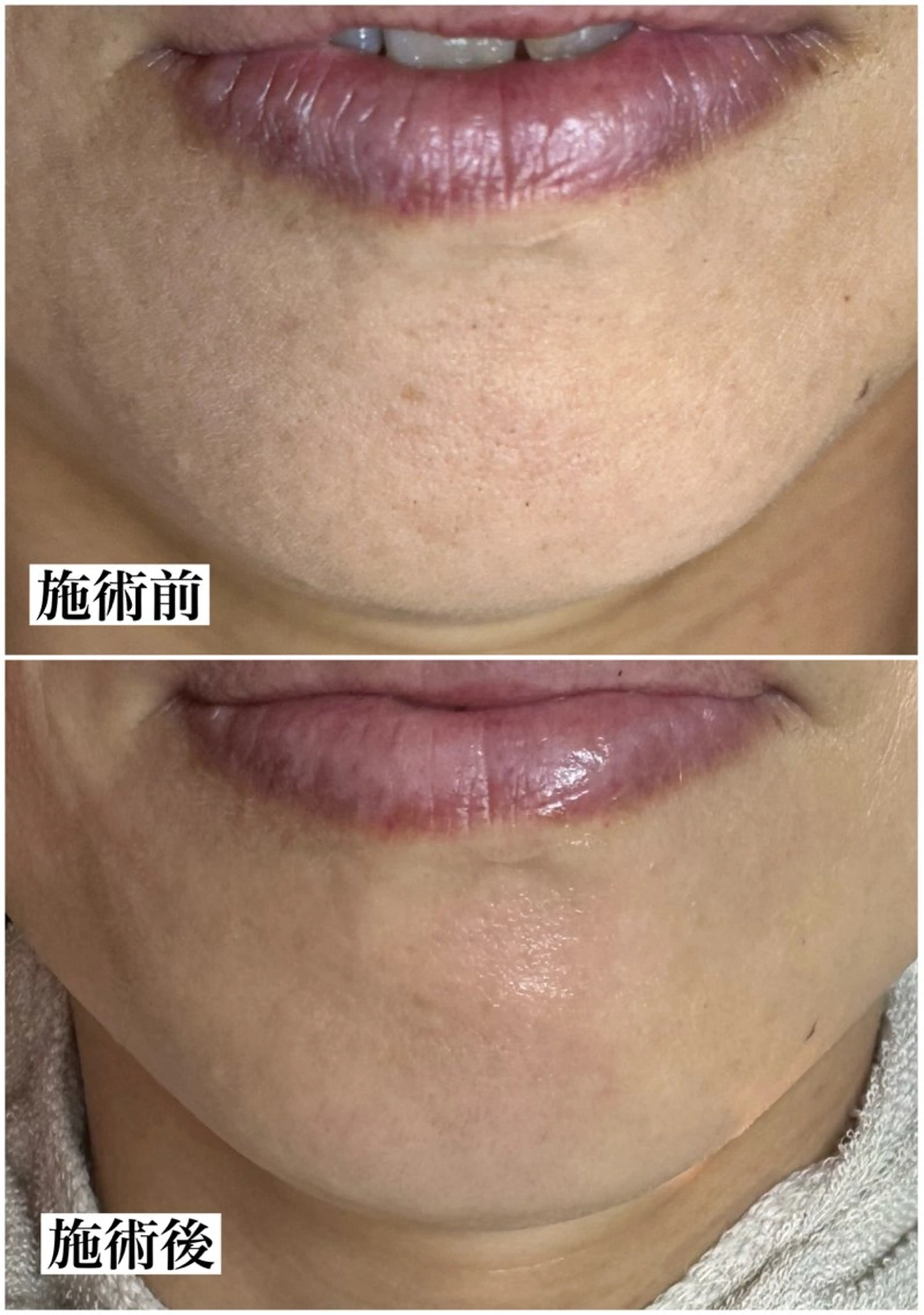 マツヤニWax専門/ 岸和田/Luanaのエステ・リラクイメージ